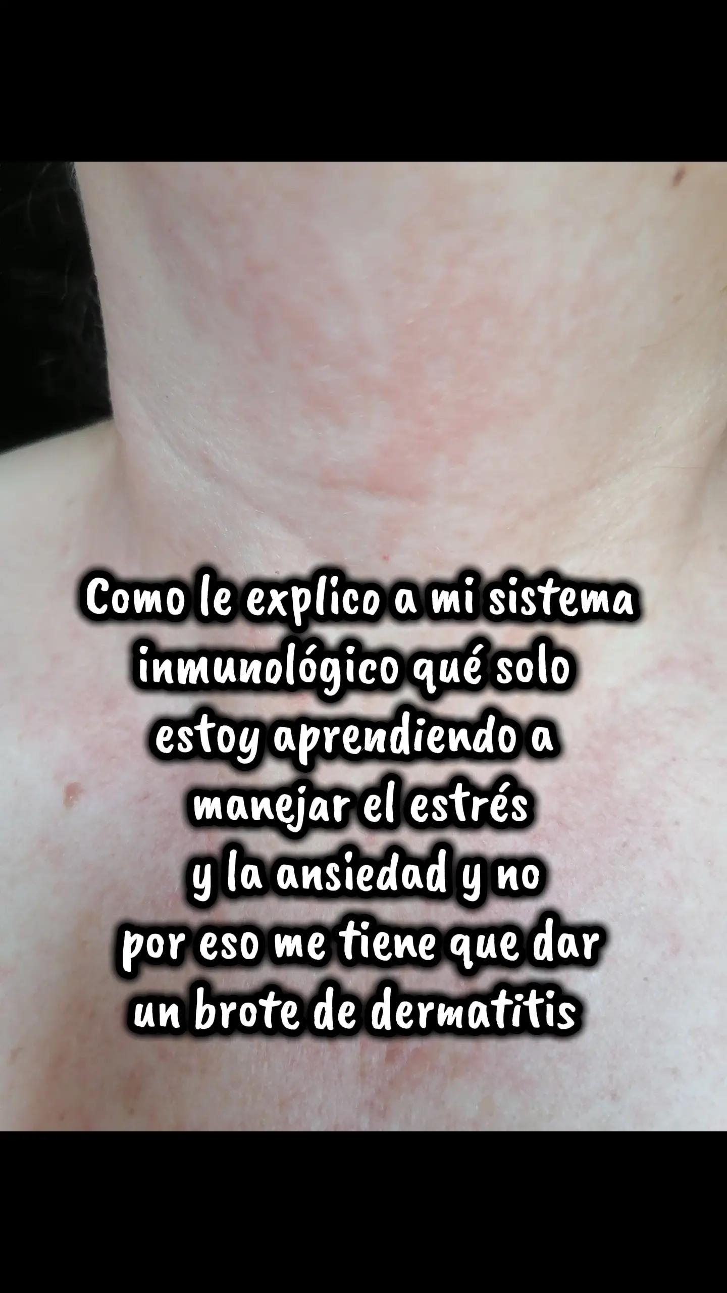 @Guerita
