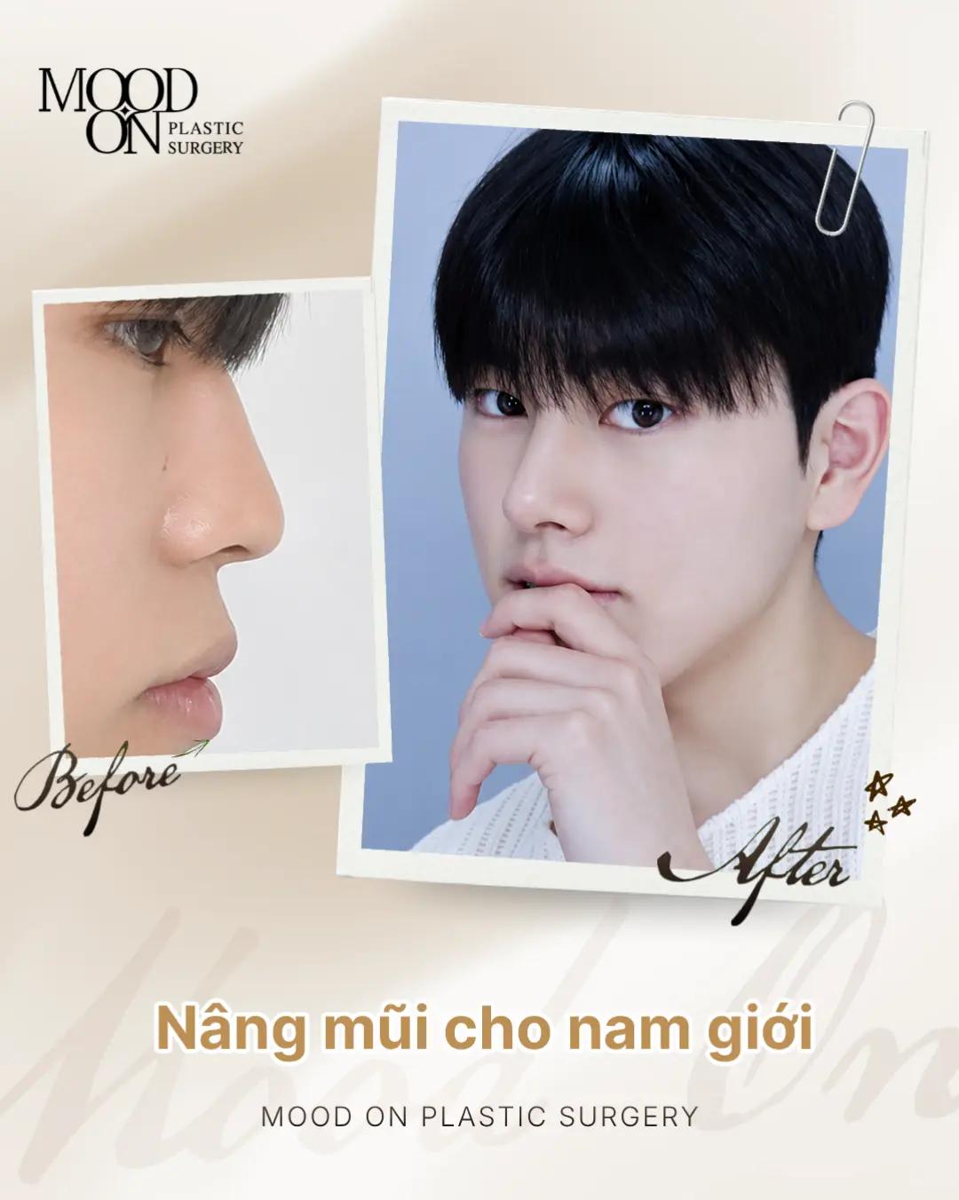 @Bệnh viện thẩm mỹ Mood On