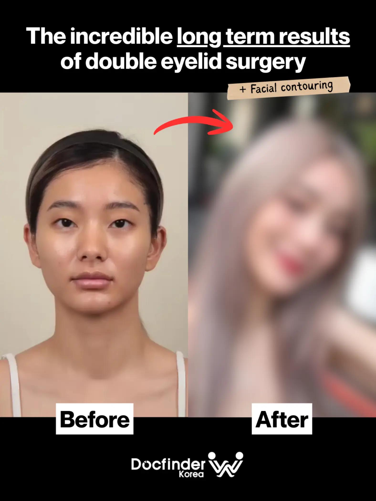 @Docfinderkorea