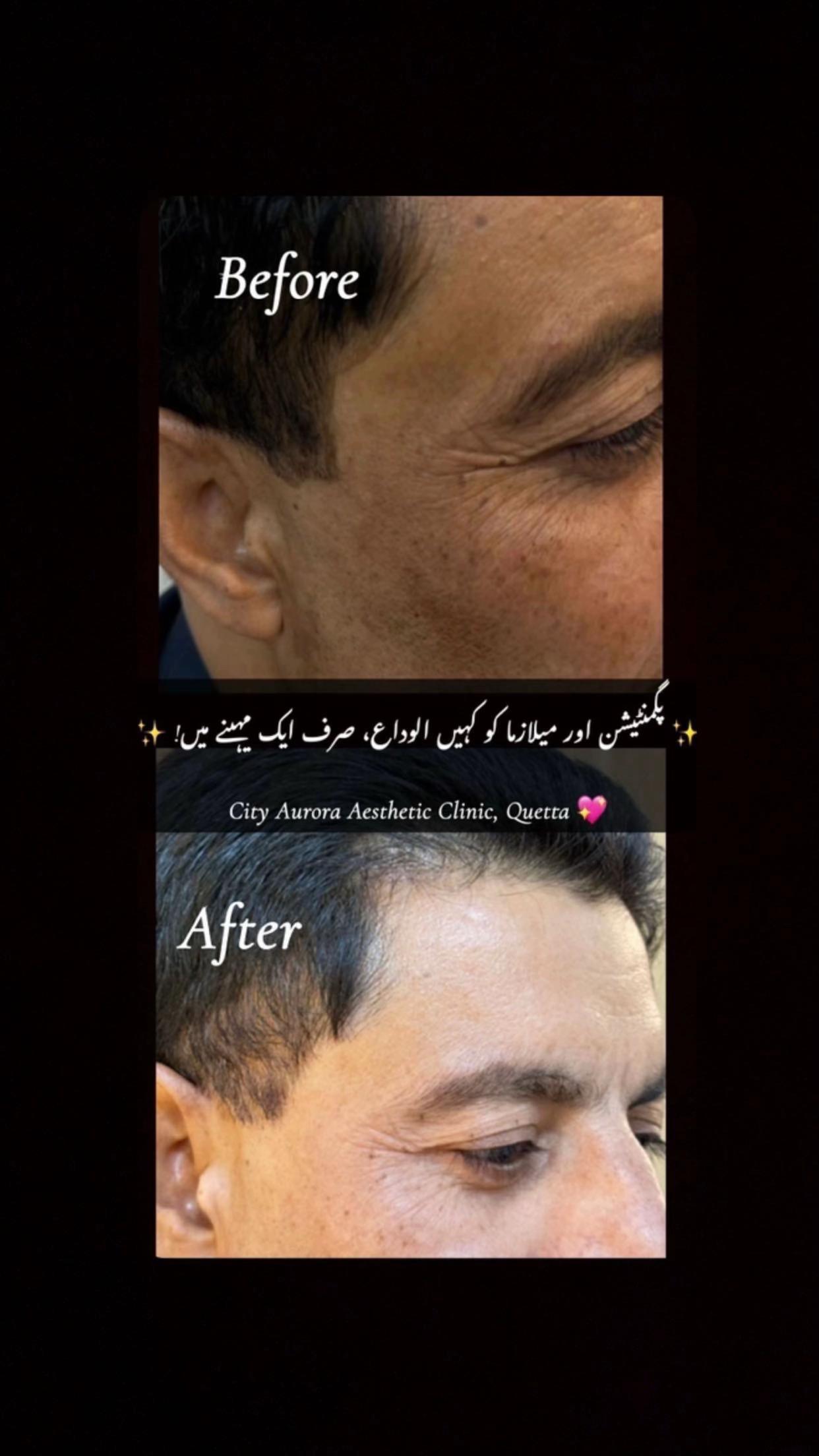 @City Aurora Asthetic clinic