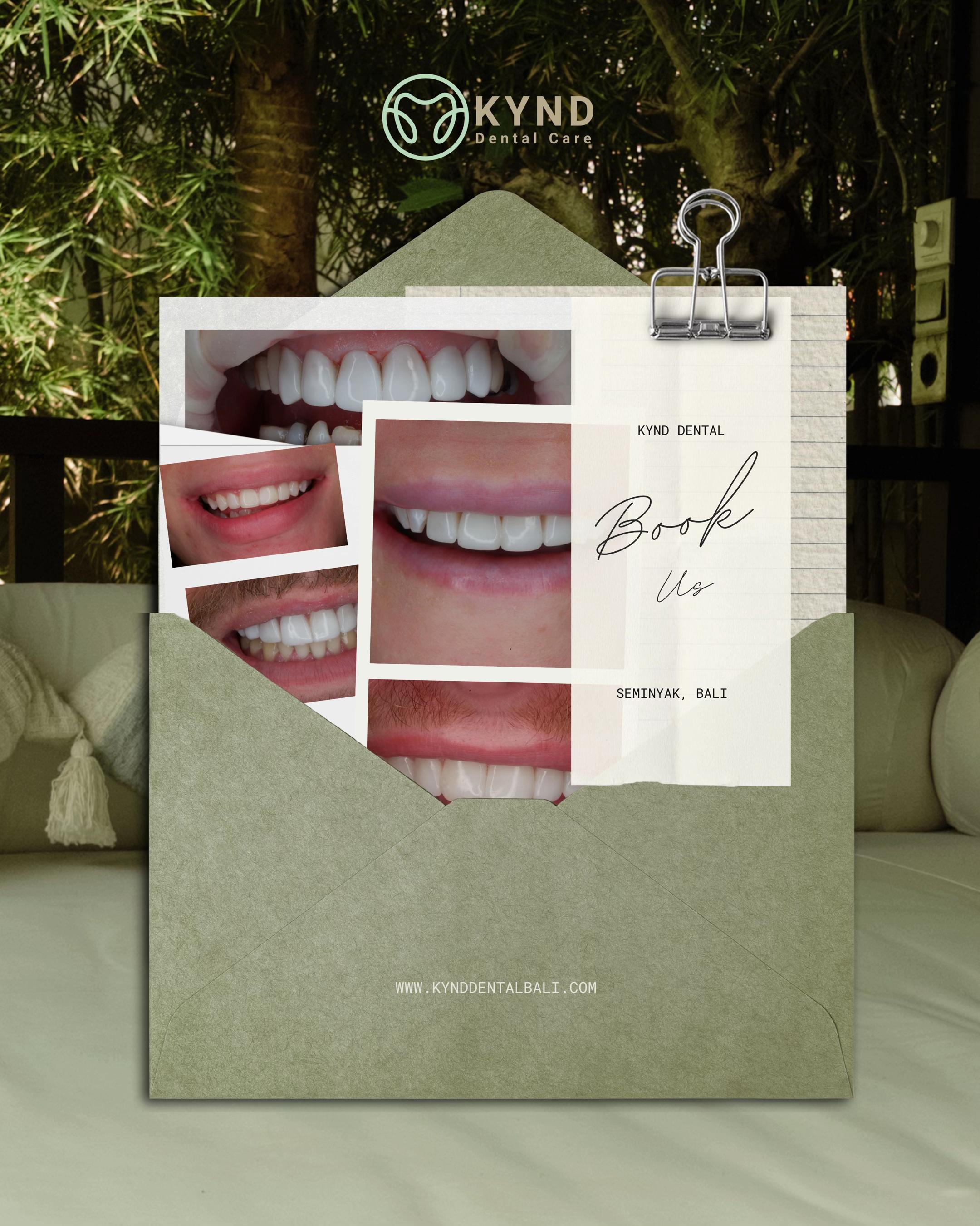 @KYND Dental Care |Dentist BALI