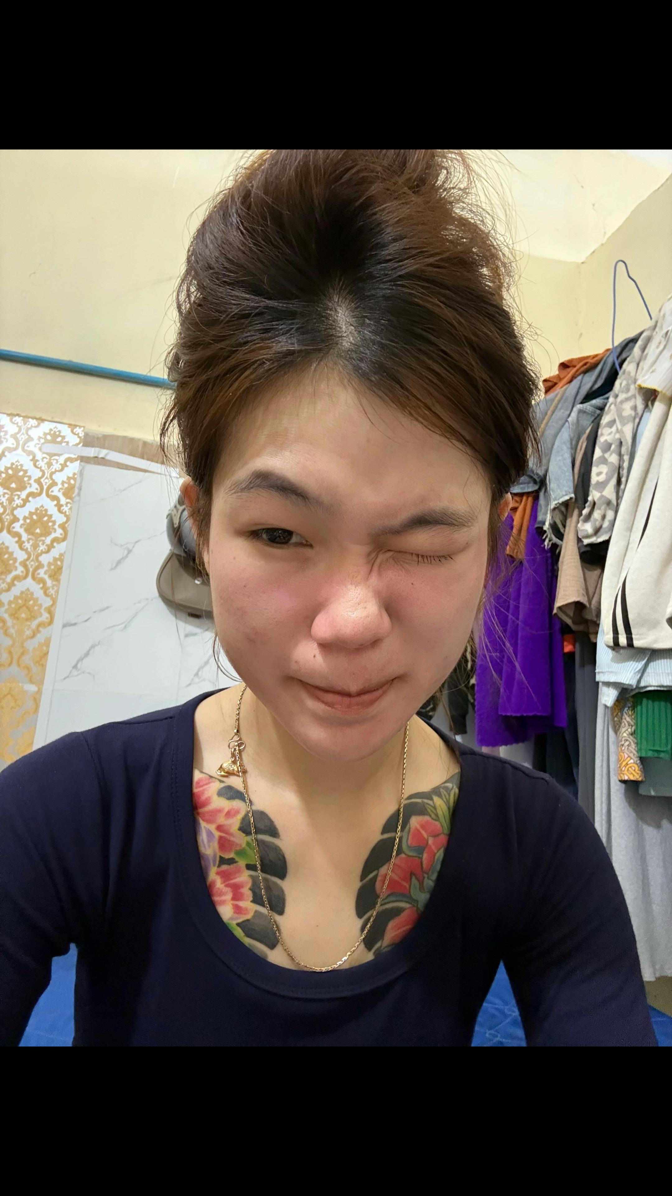 @Ach ko๐