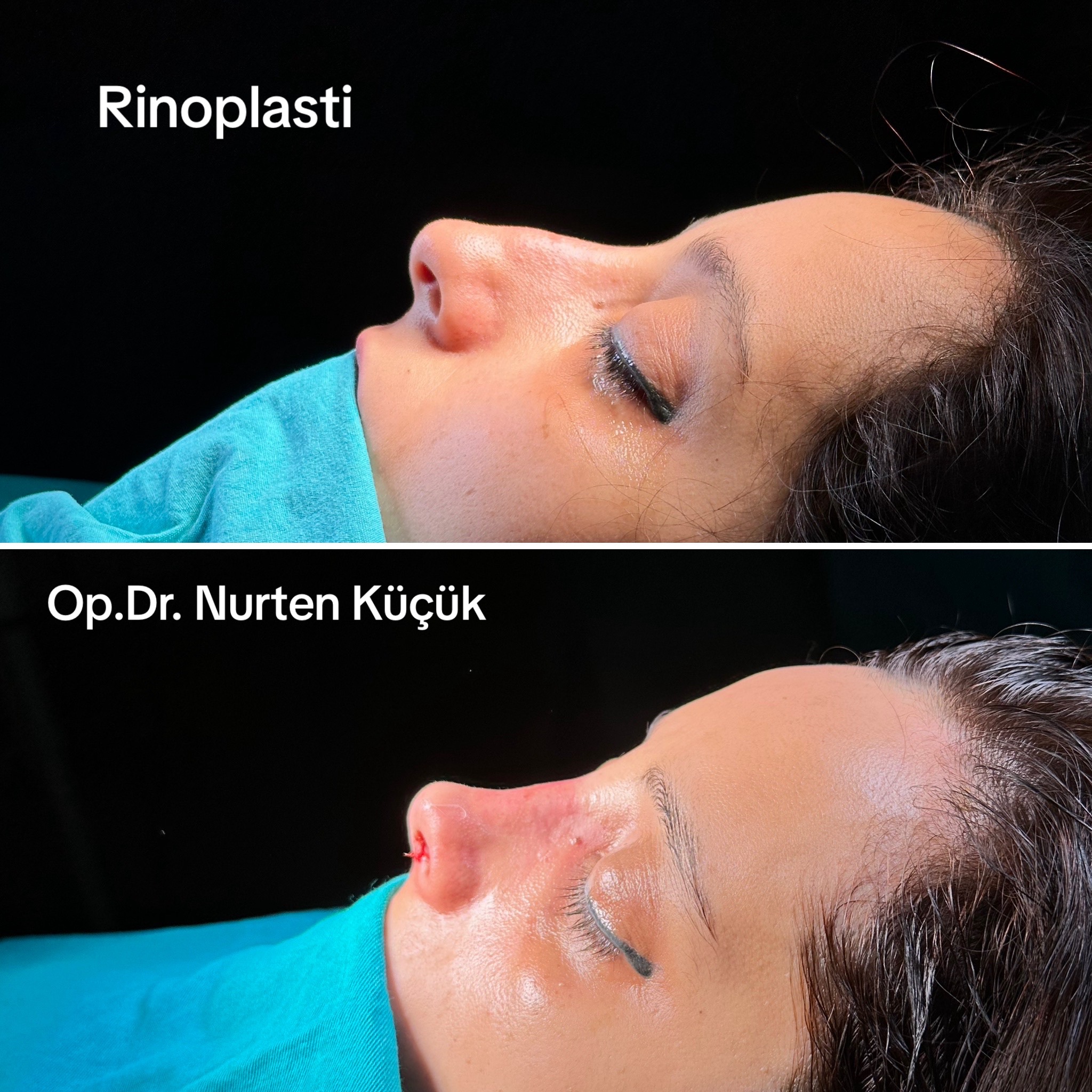 @Dr. NurtenKucuk