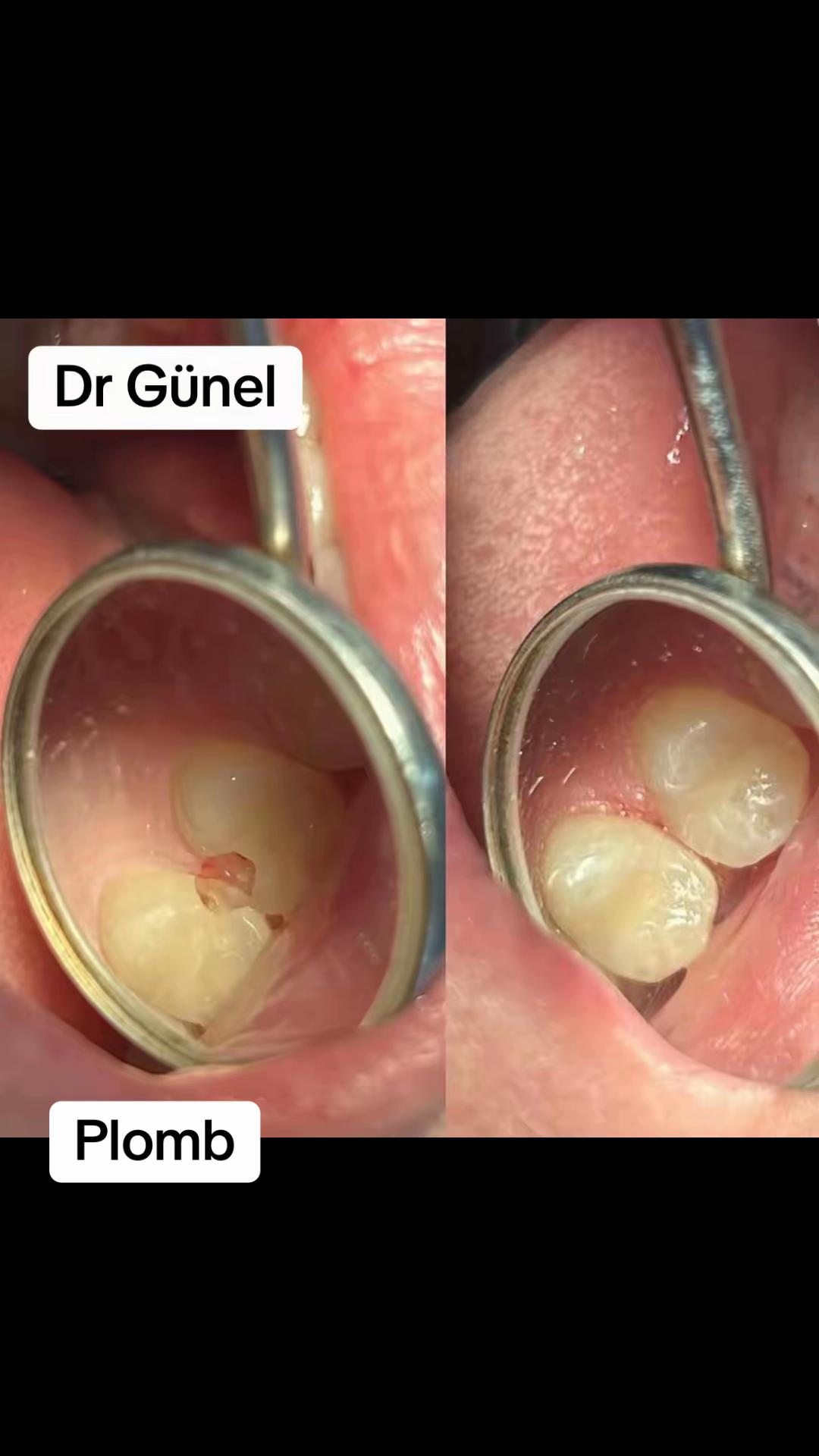 @Dentist_Günel