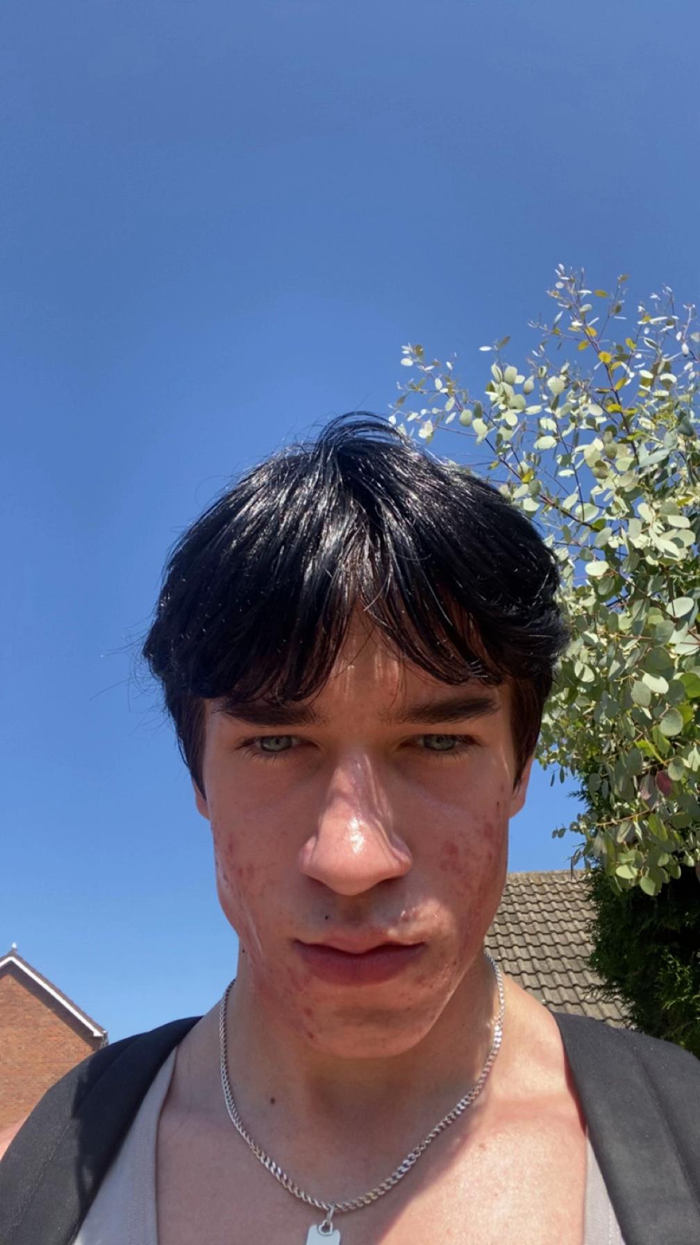 @Jakub🇵🇱