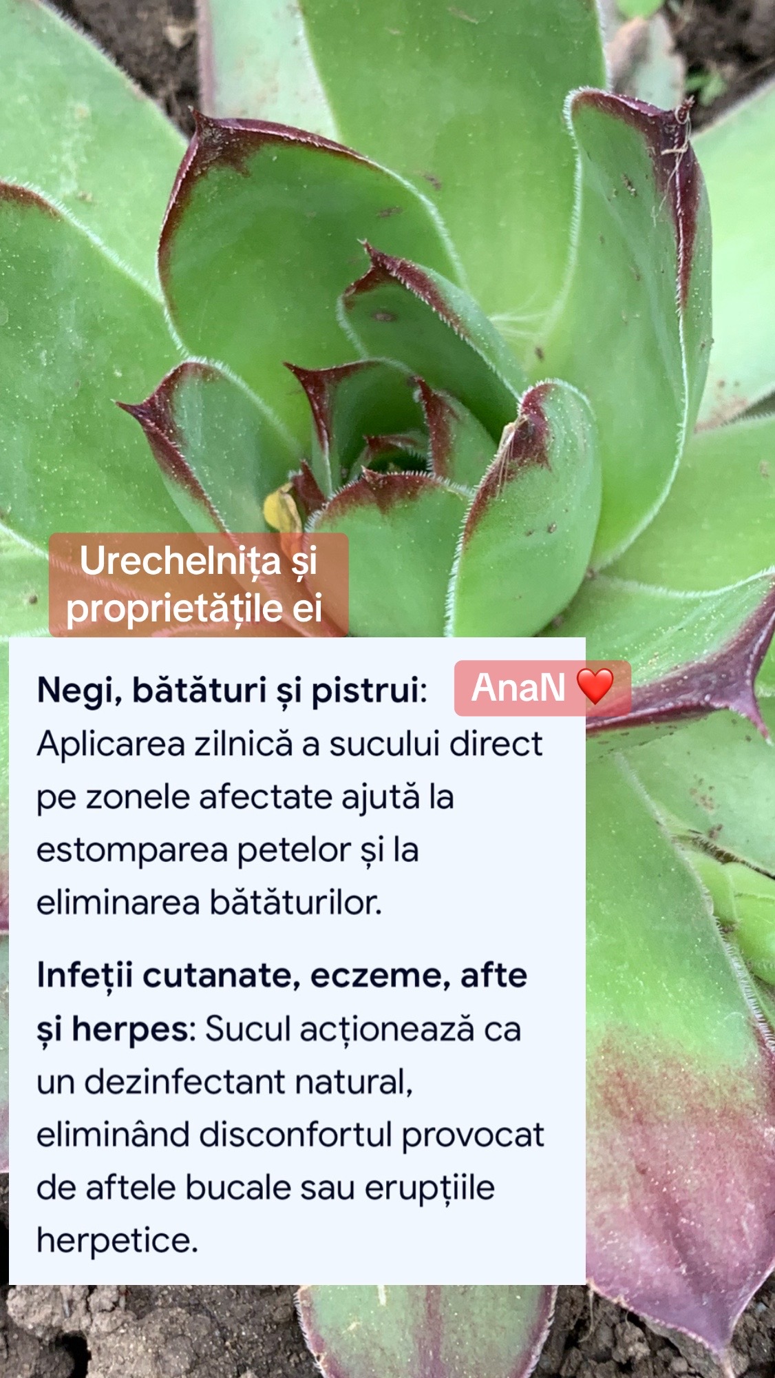 @Ana-N.