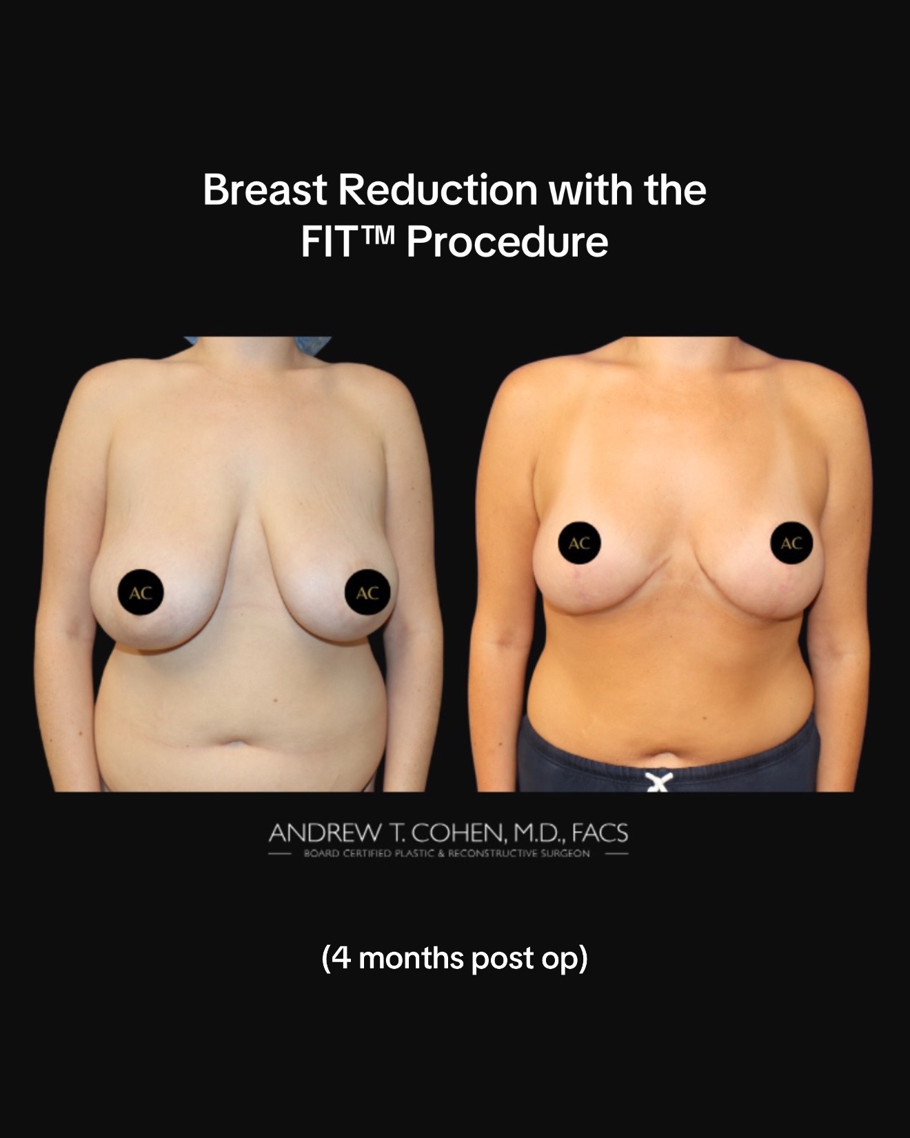 @Cohen MD Plastic Surgery