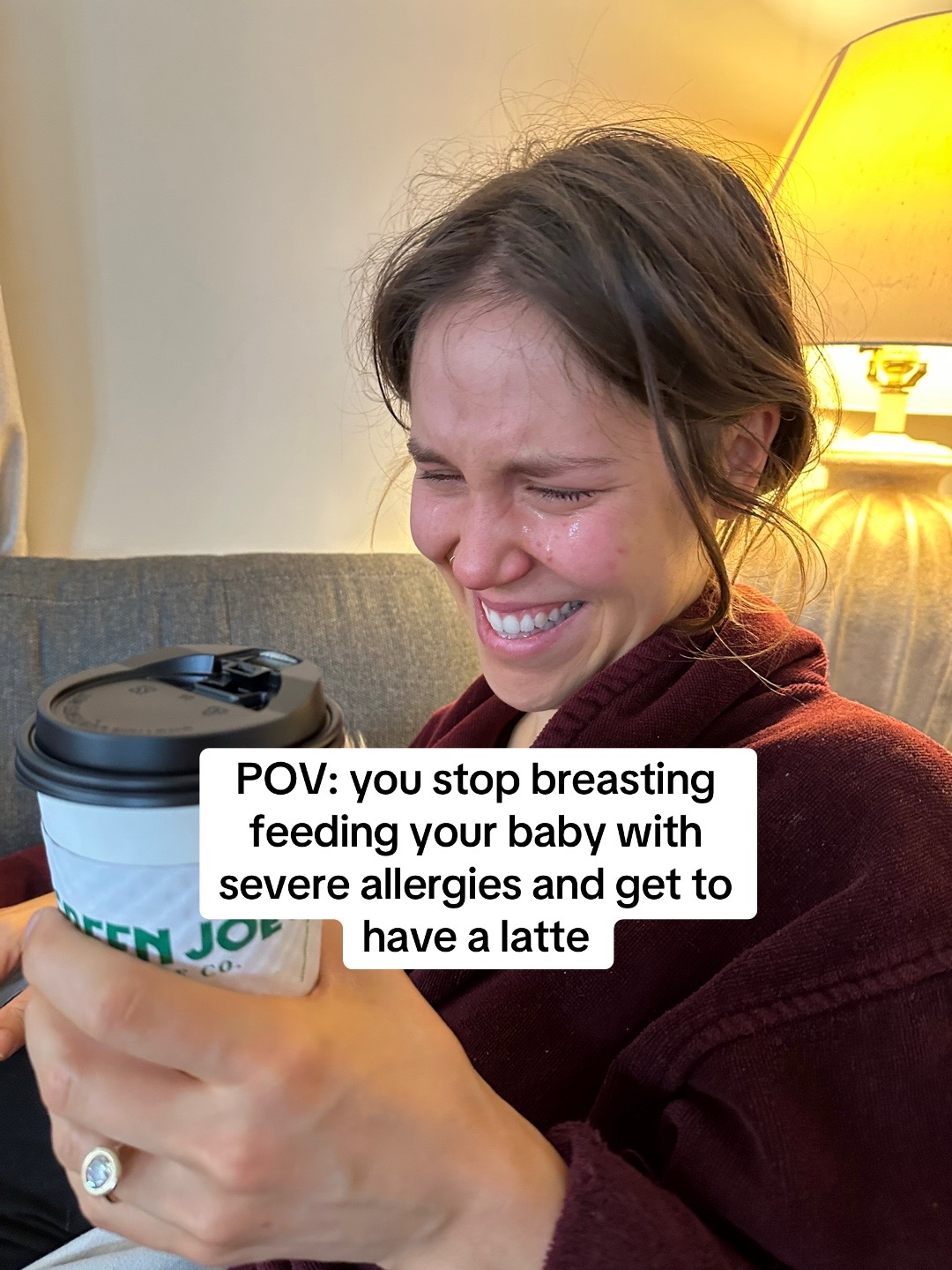 @Eczemama