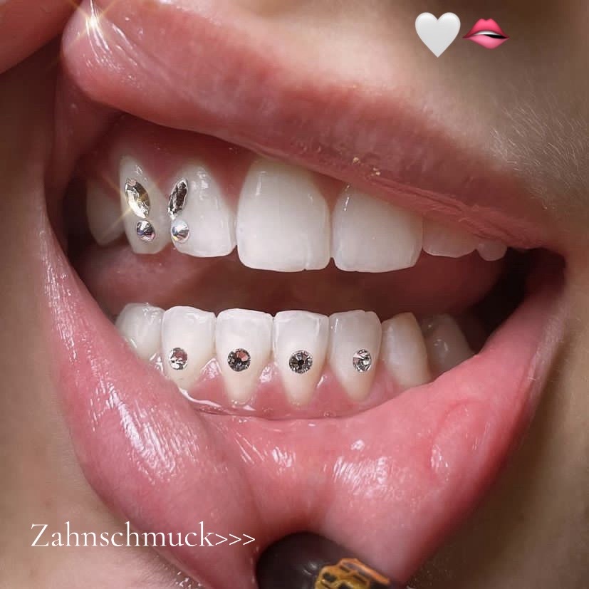 @Zahnschmuck_