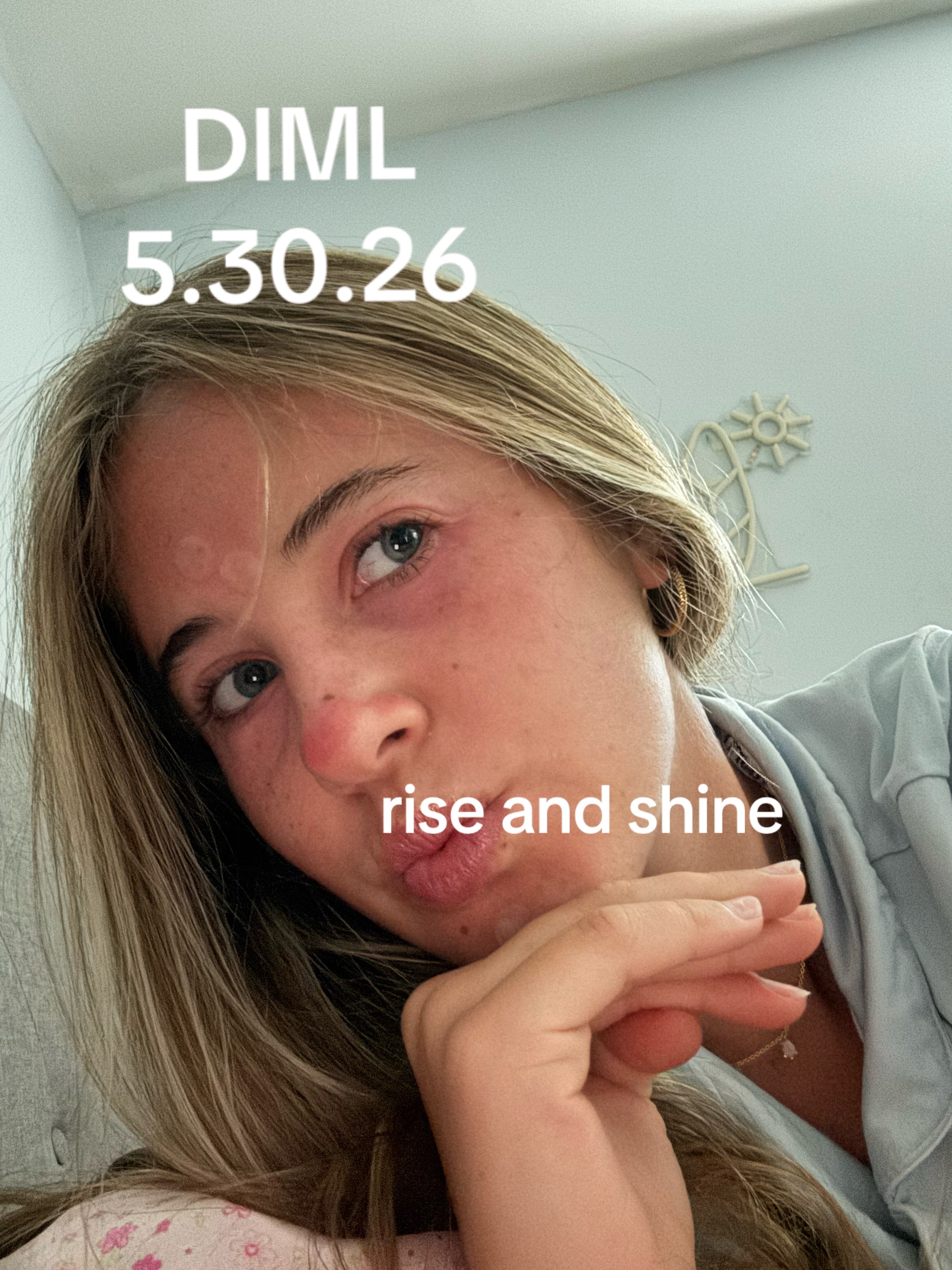 @Anna Zimmerman