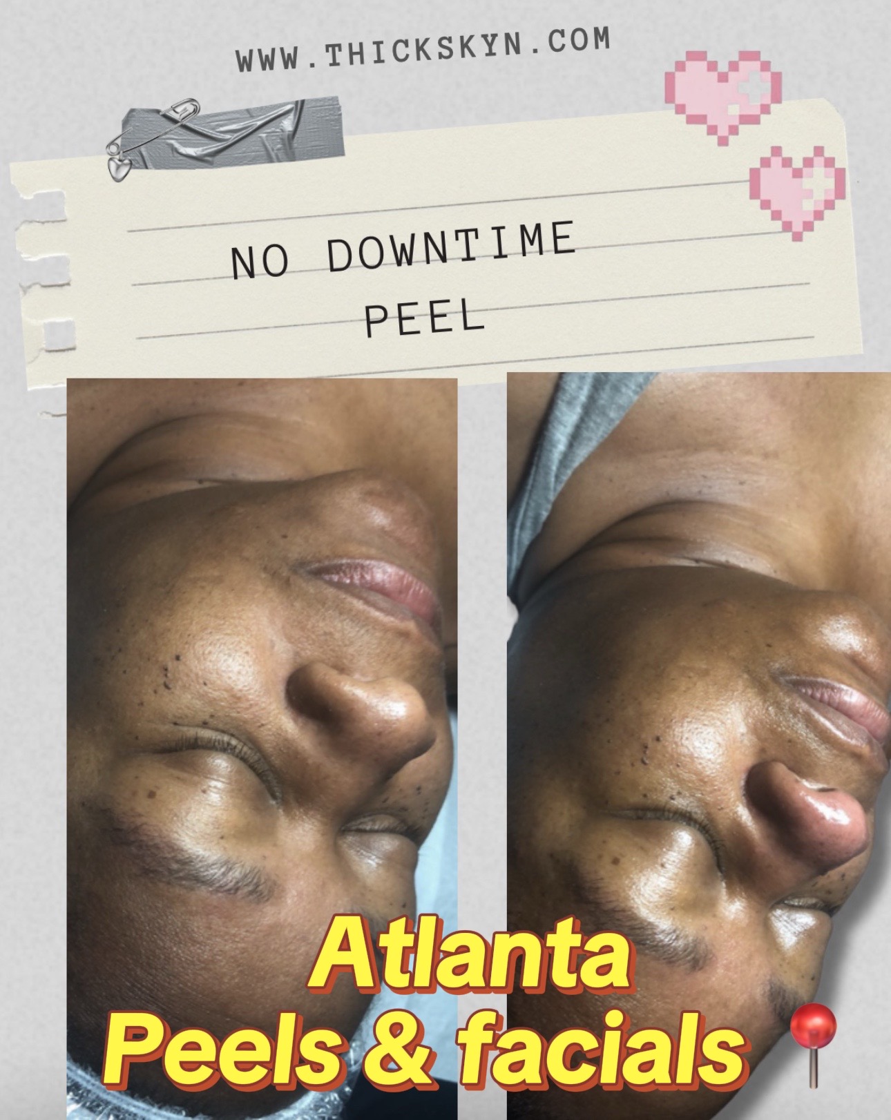 @Atlanta Esthetician & Facials