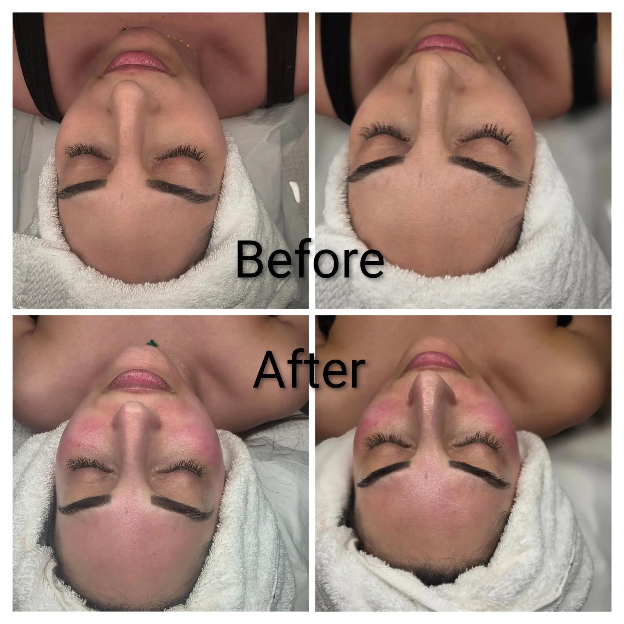 @EL Beauty & Aesthetic