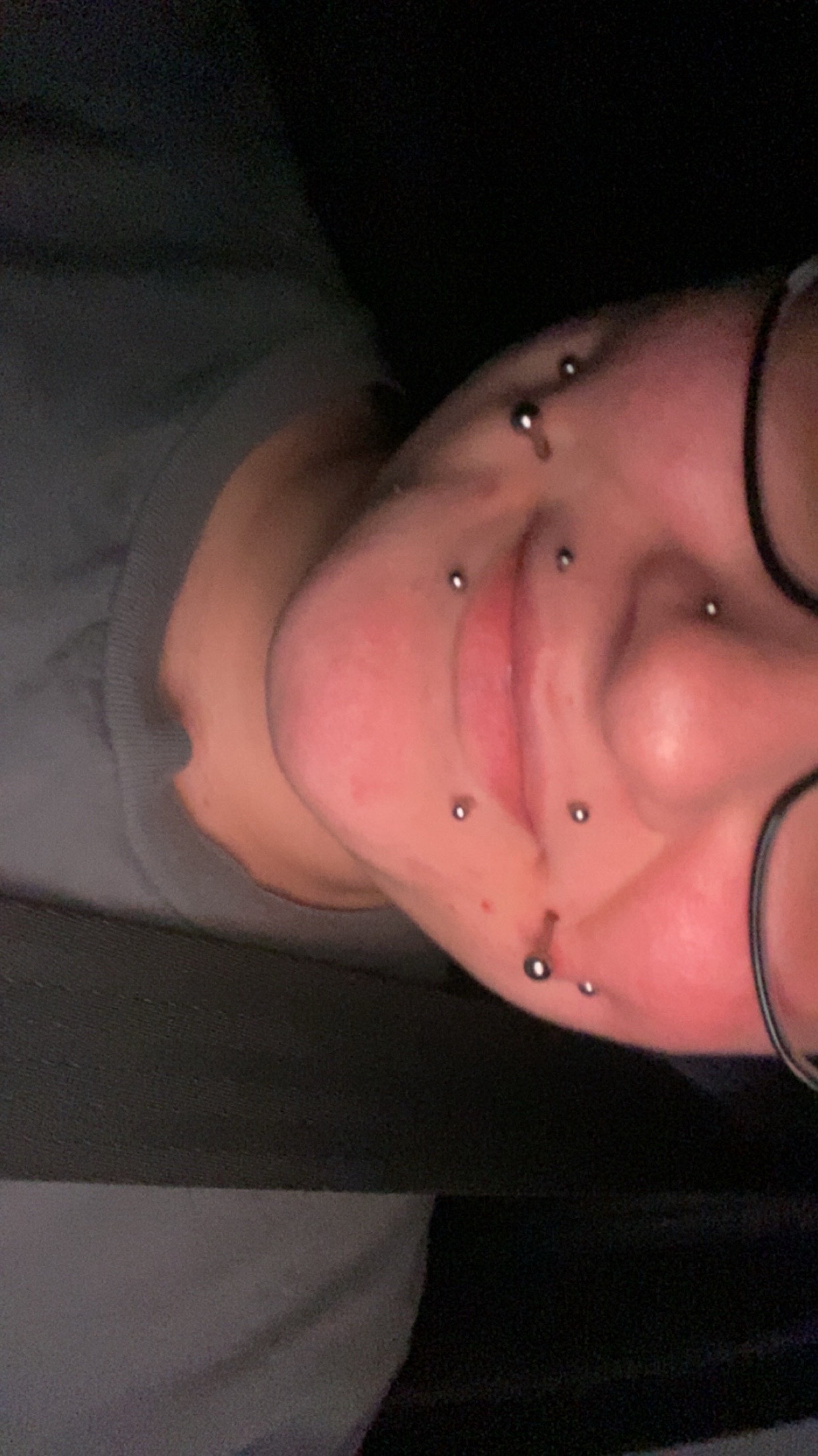 @leah_laceration