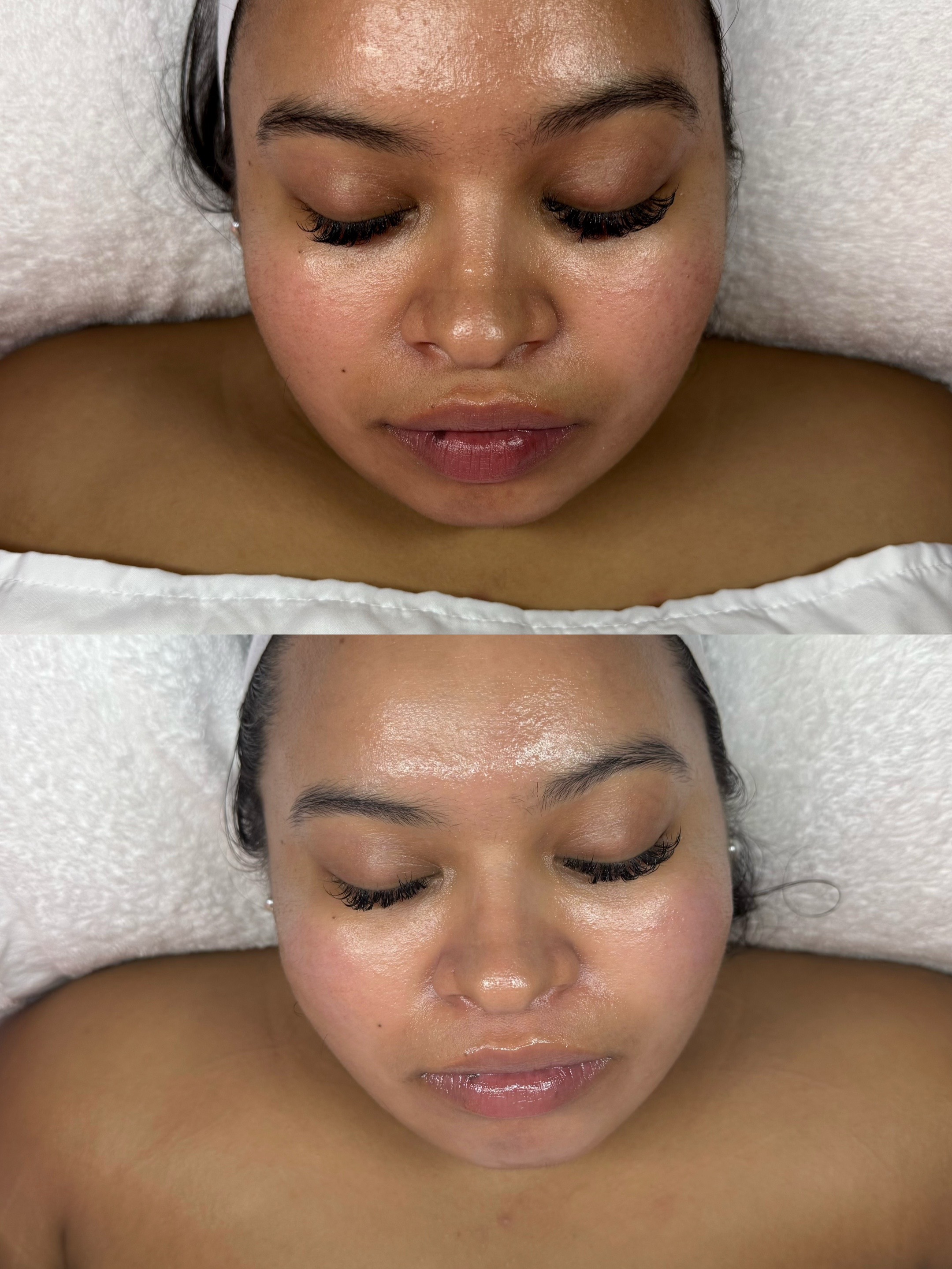 @HappySkinBySara