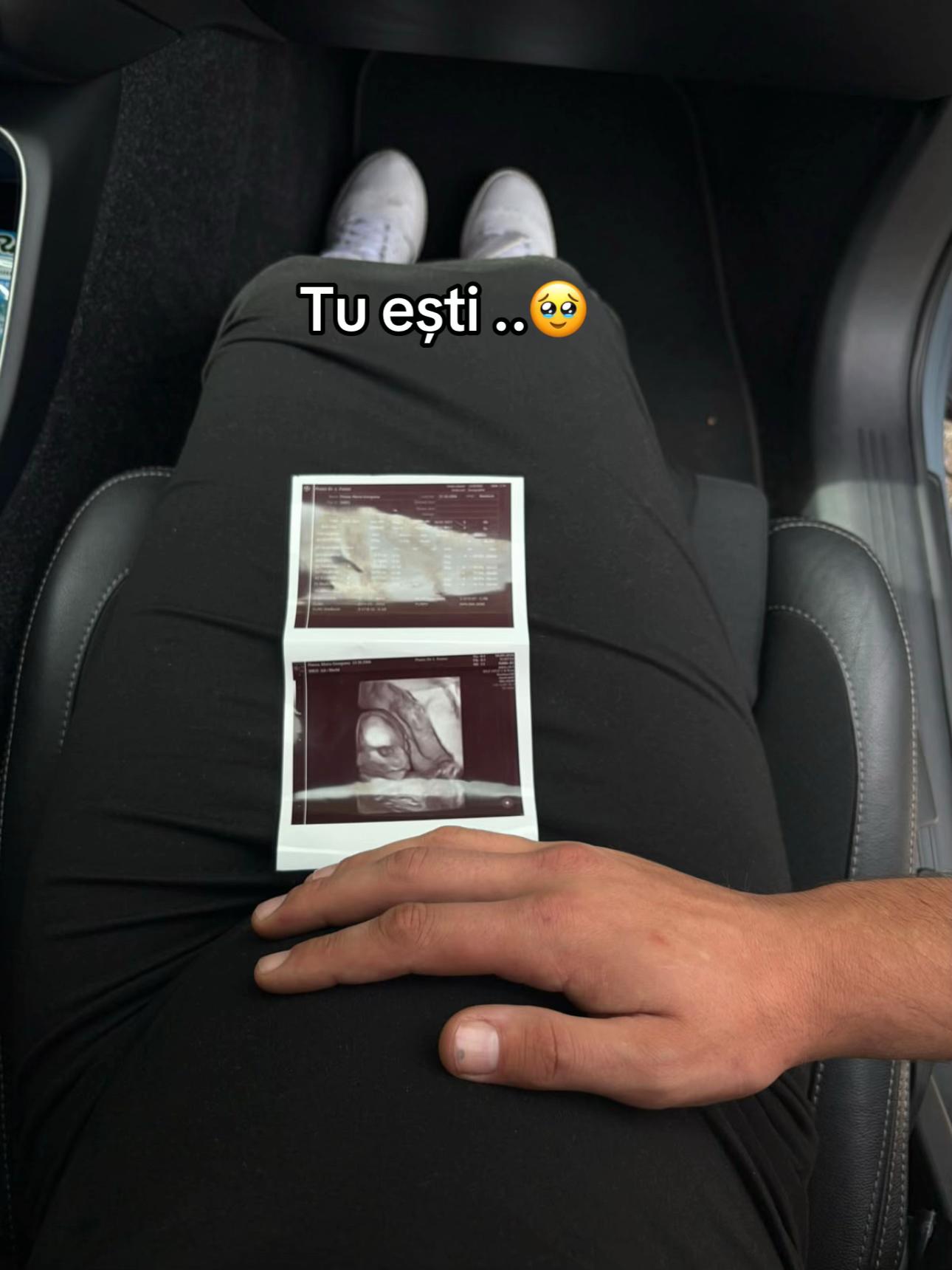 @milea_giorgiana22
