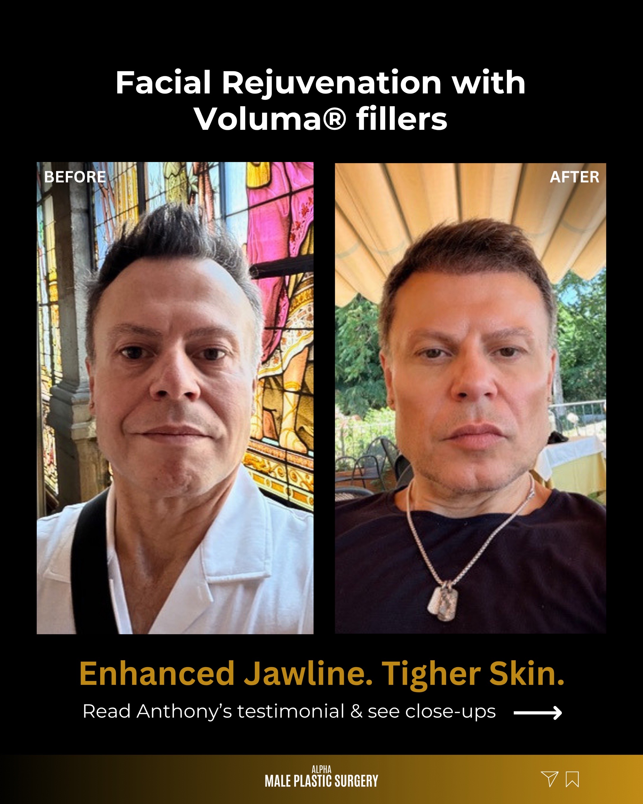 @mensplasticsurgery