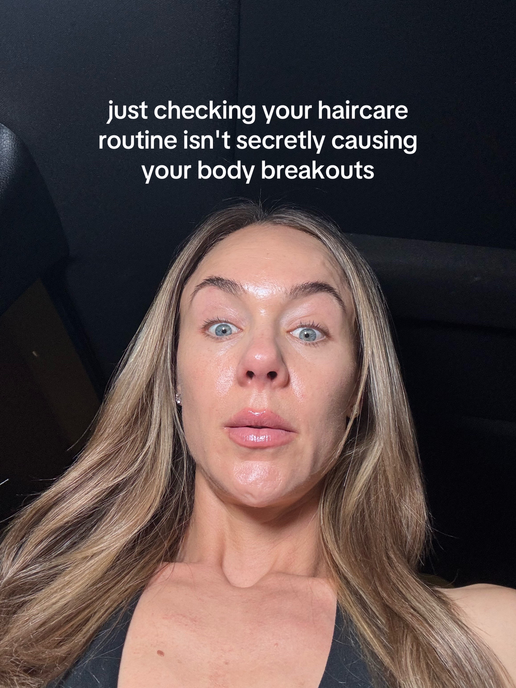 @Celeste | RN acne expert