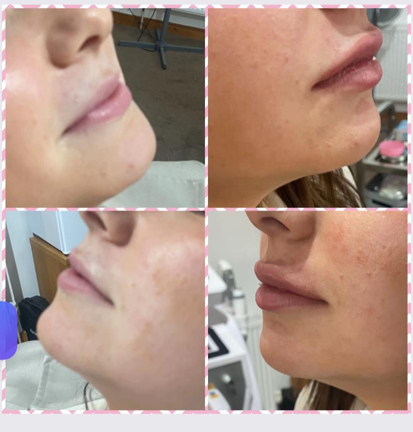 @Diamond Aesthetics Barnsley