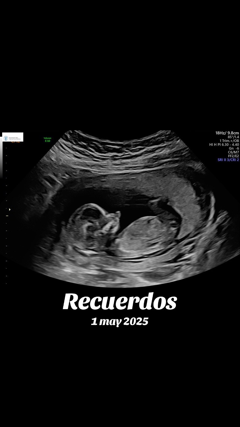 @luz.sb9