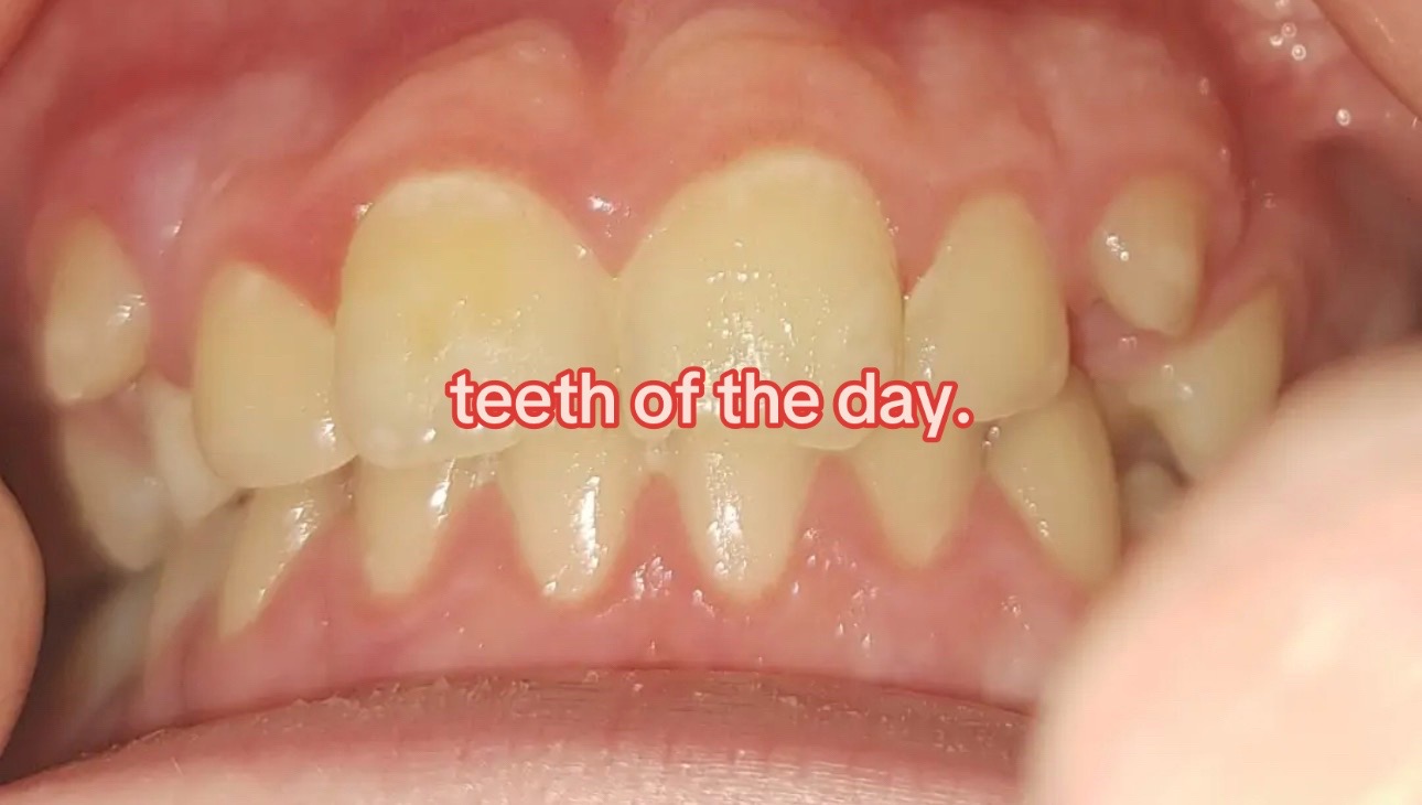 @I leik teeth moer thna mysefl.
