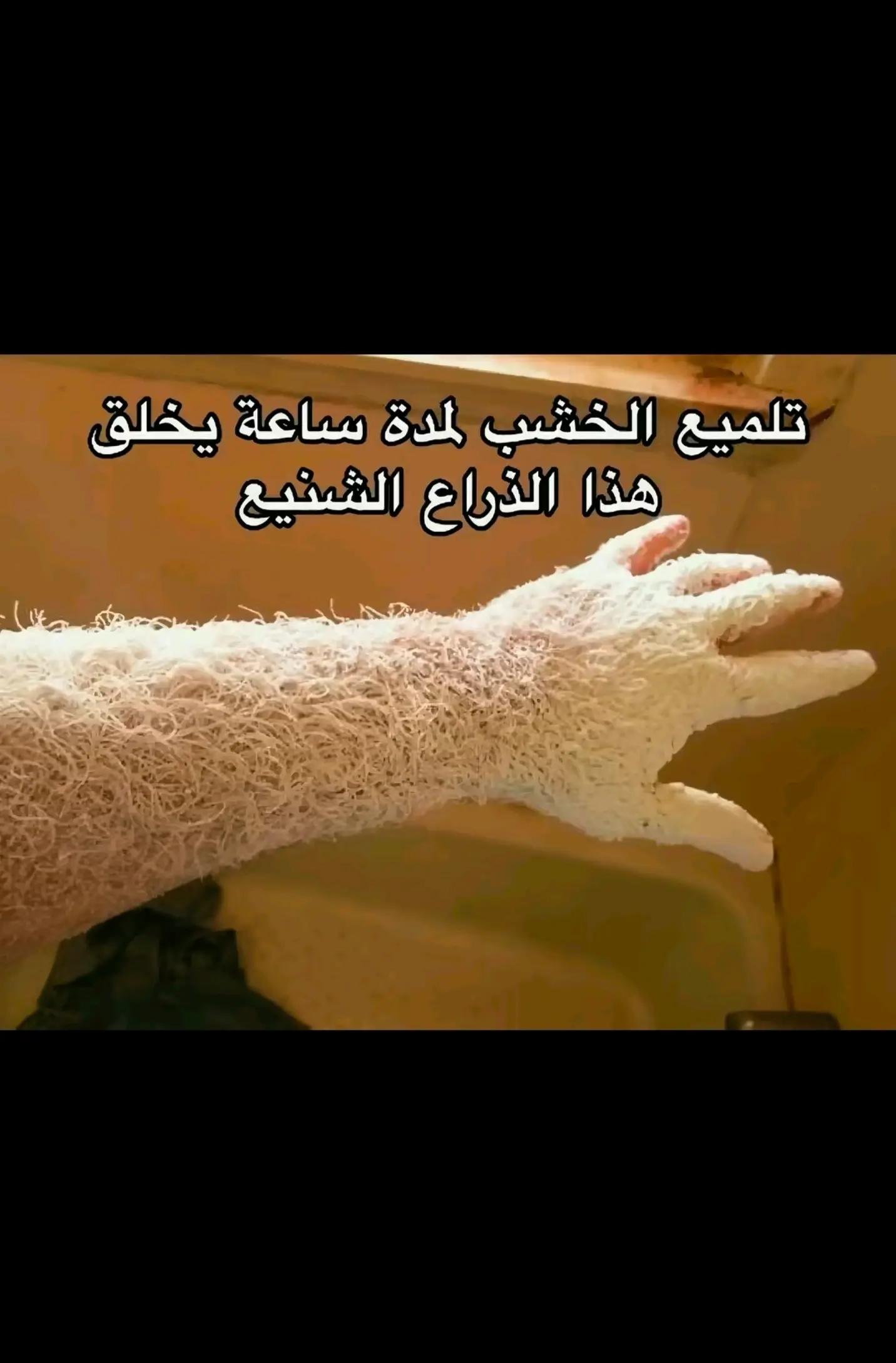 @عبد الرحمــٰن | 1427 هـ