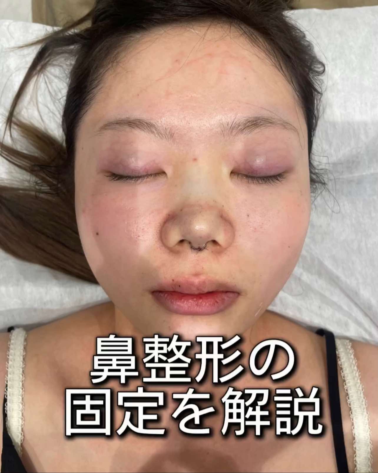 @鼻整形R Beauty CLINIC 副院長👨&zwj;⚕️吉田慧