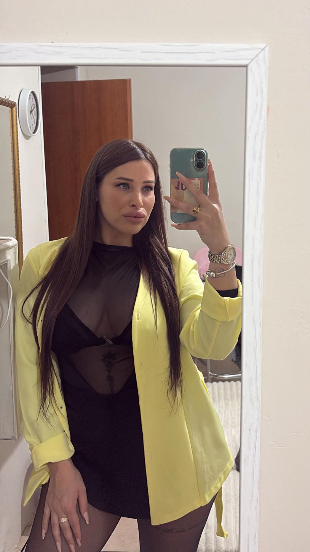 @17