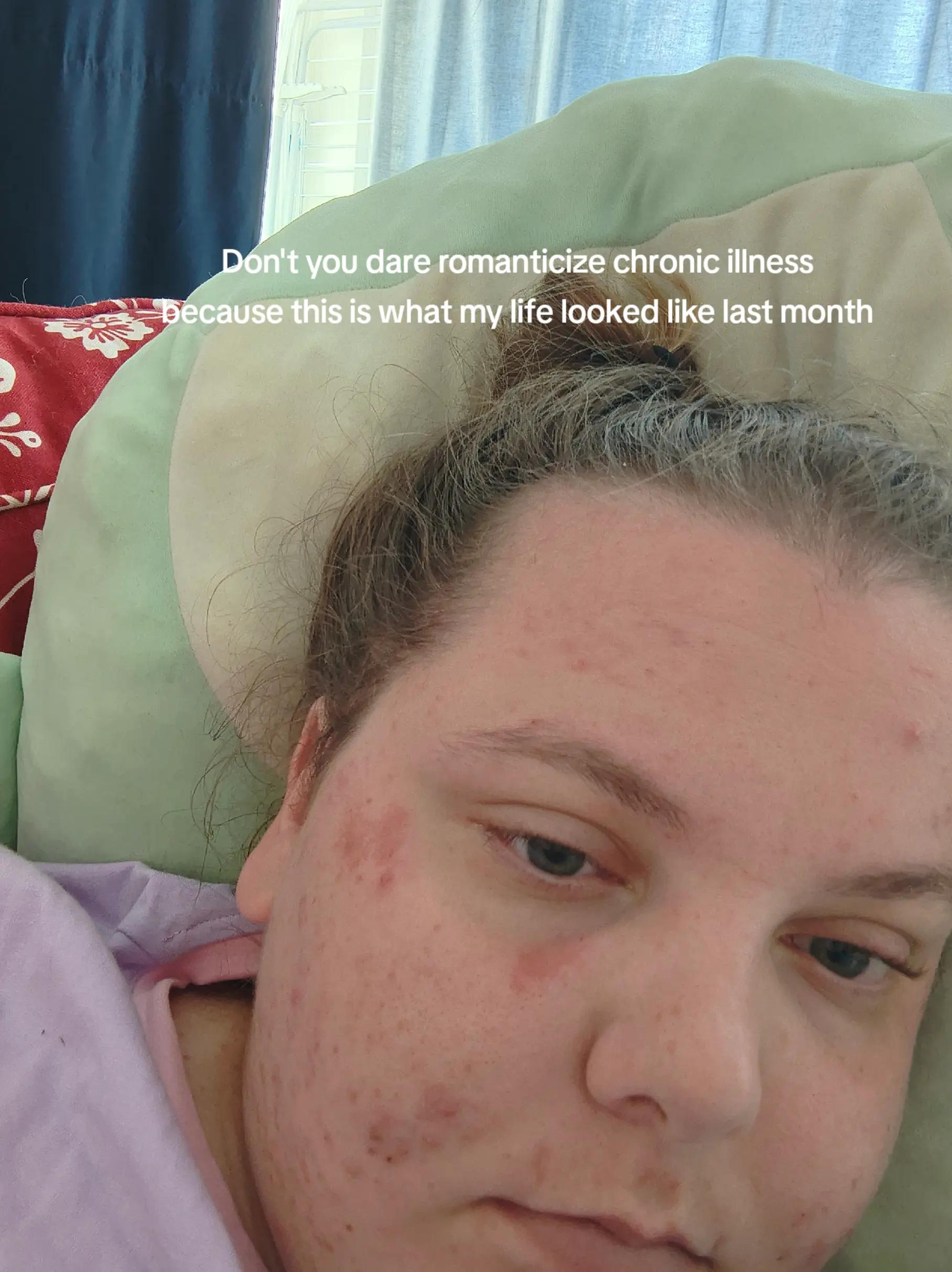 @Chronicwarrior