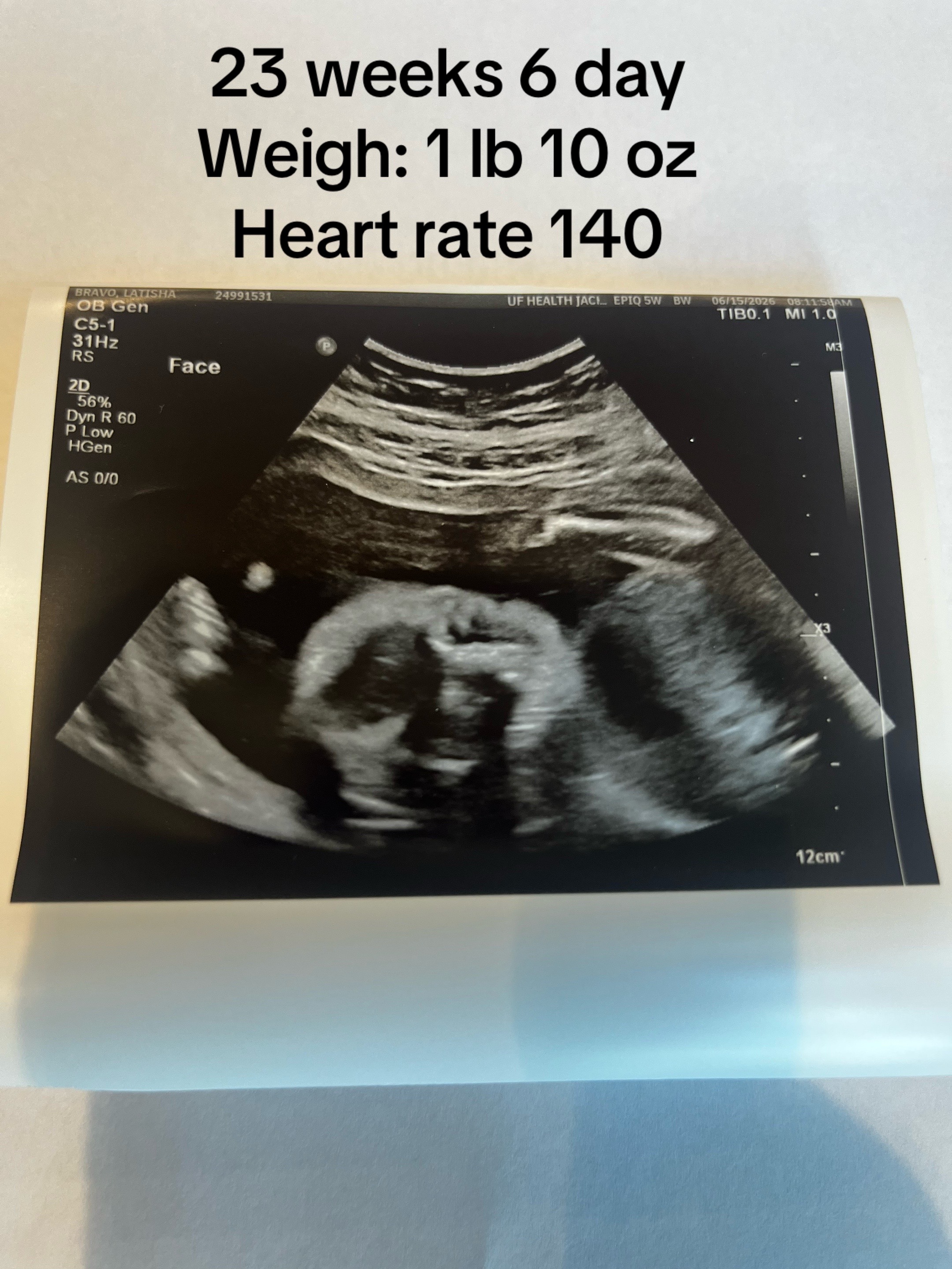 @Latisha IVF & Motherhood
