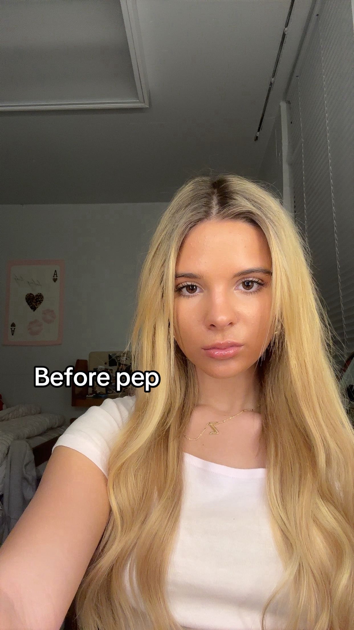 @zoe
