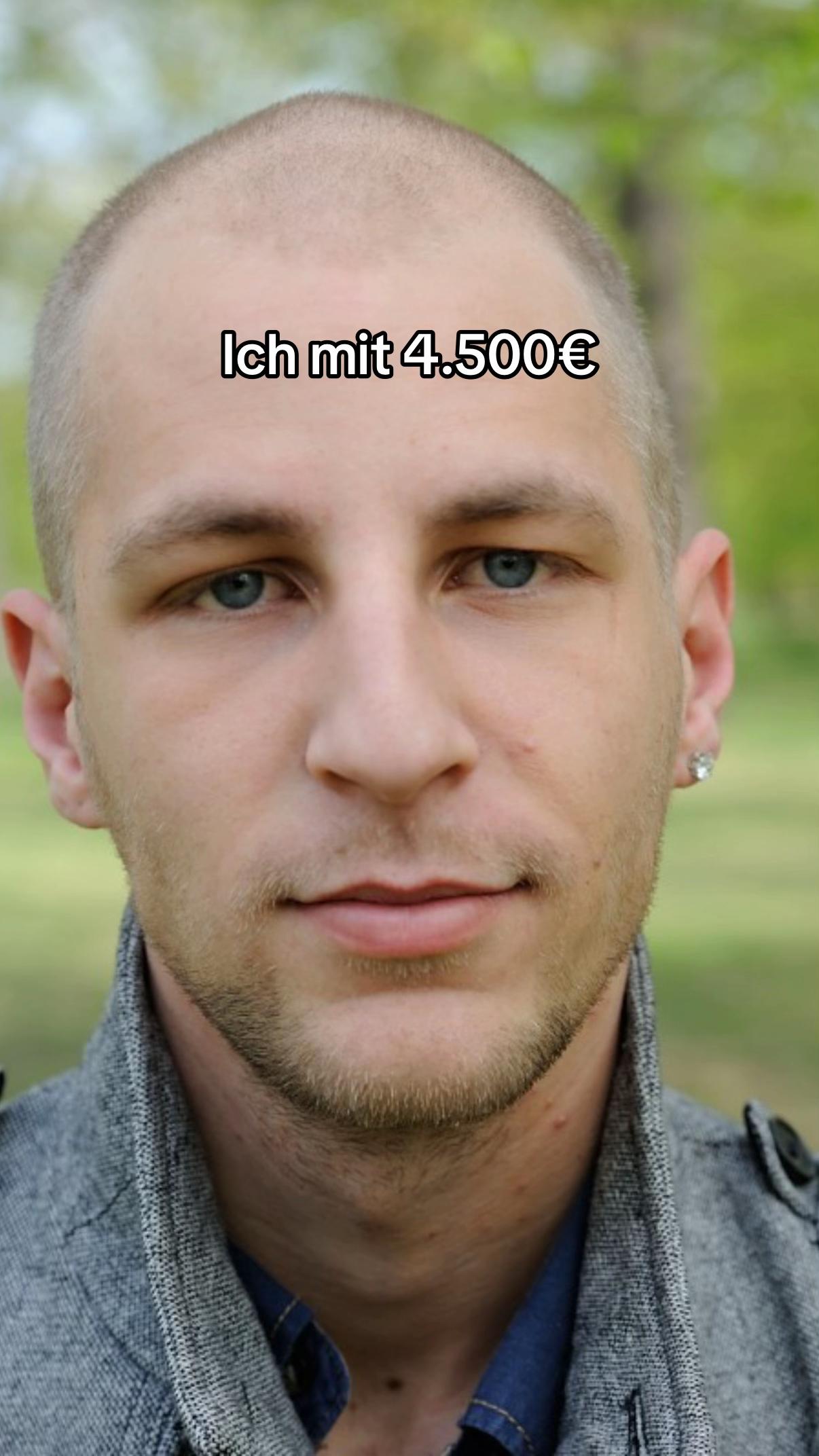 @Mr. Hairtransplant