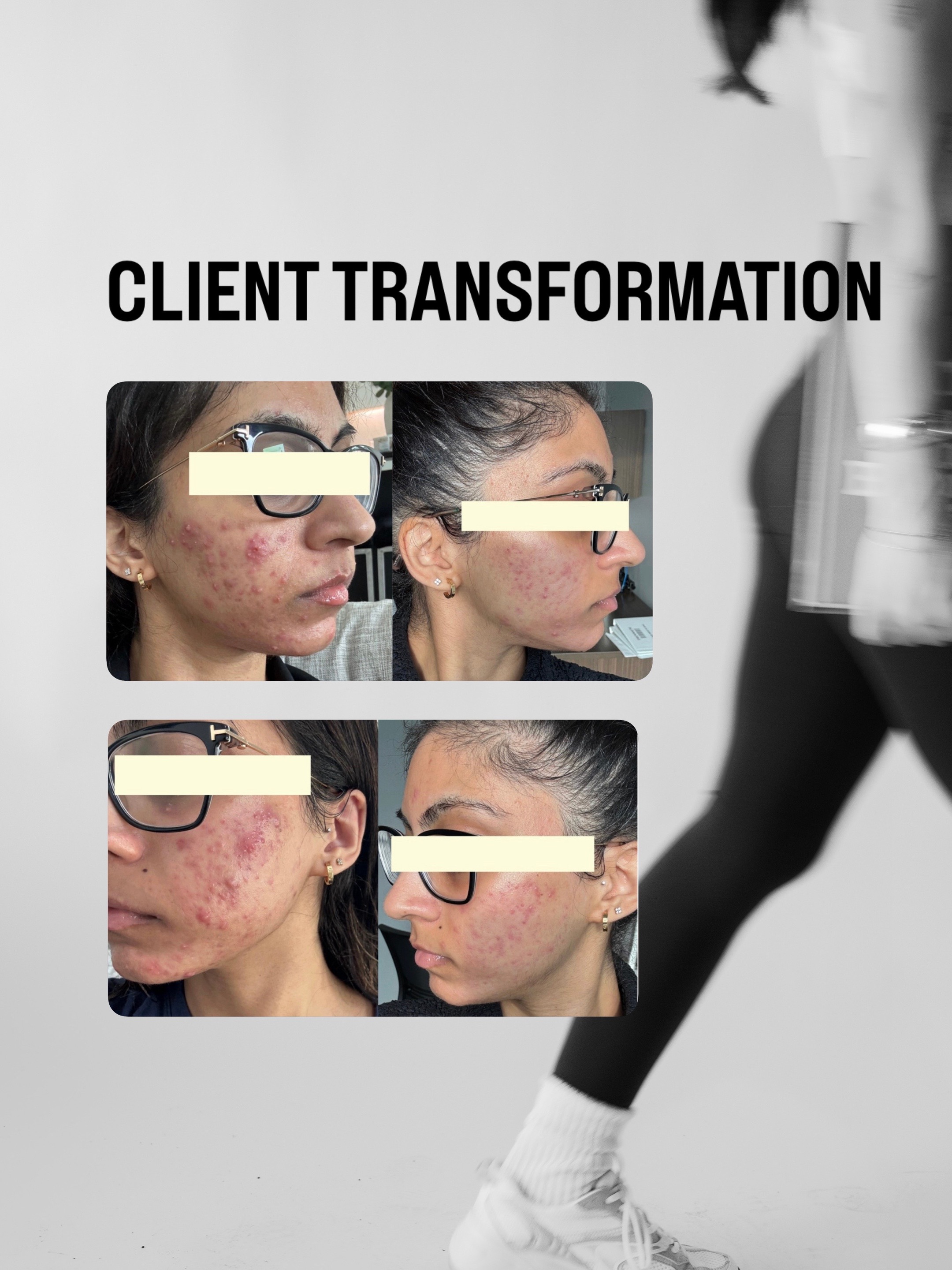@Doctor Sheyda | Acne Expert