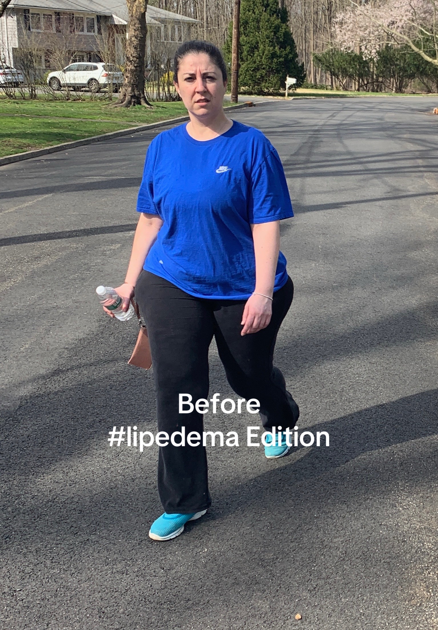 @Patty I Lipedema Lifestyle 💜