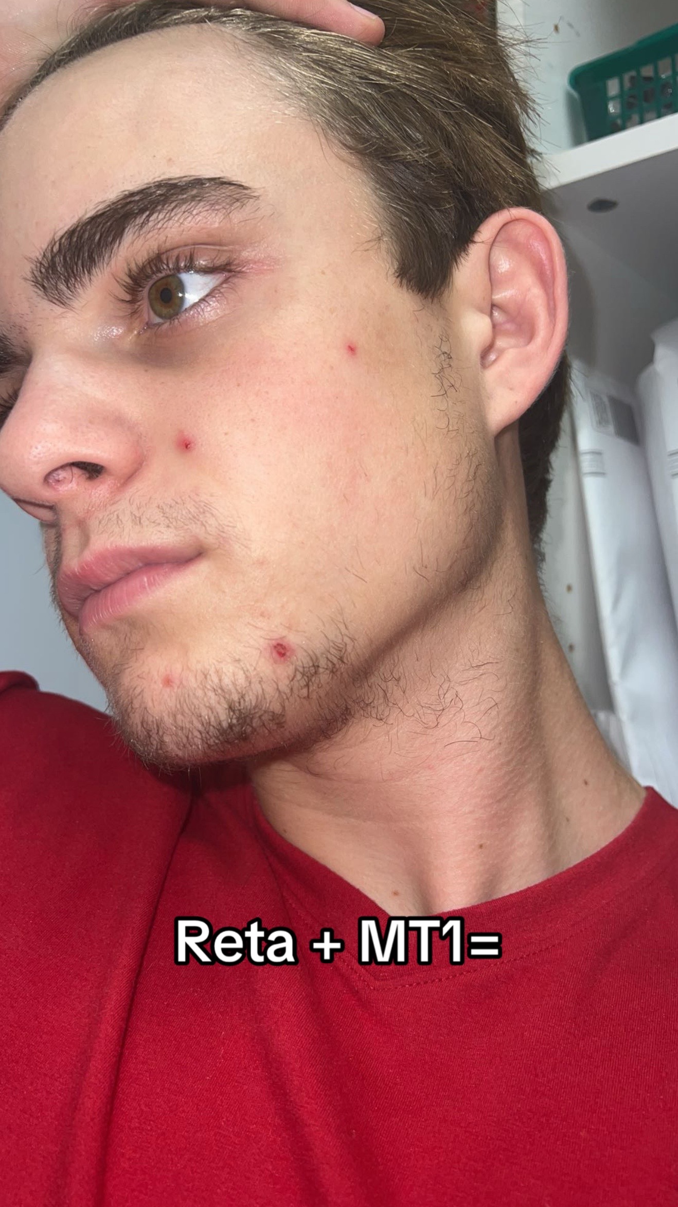 @Oliver Tamposi