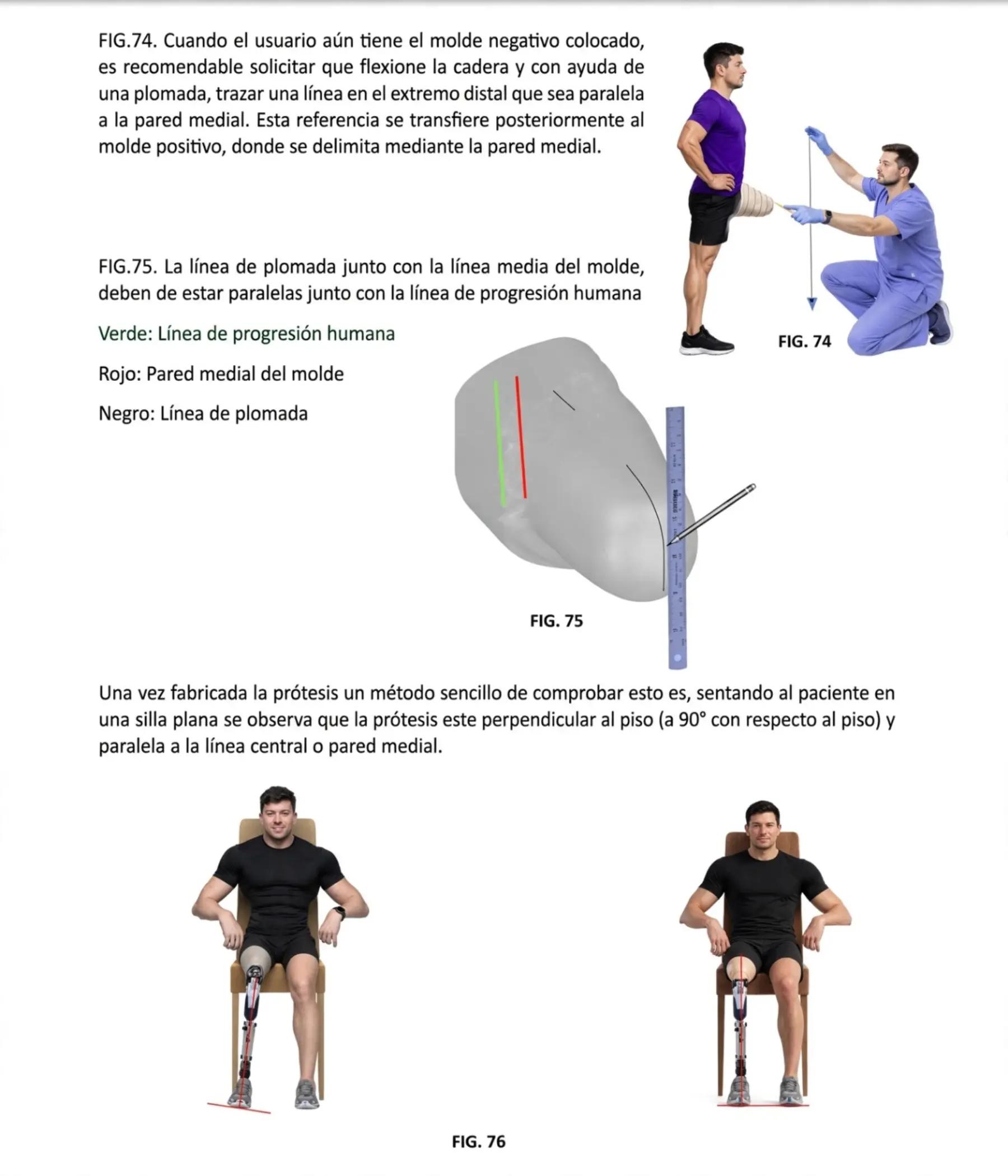 @Customized Prótesis