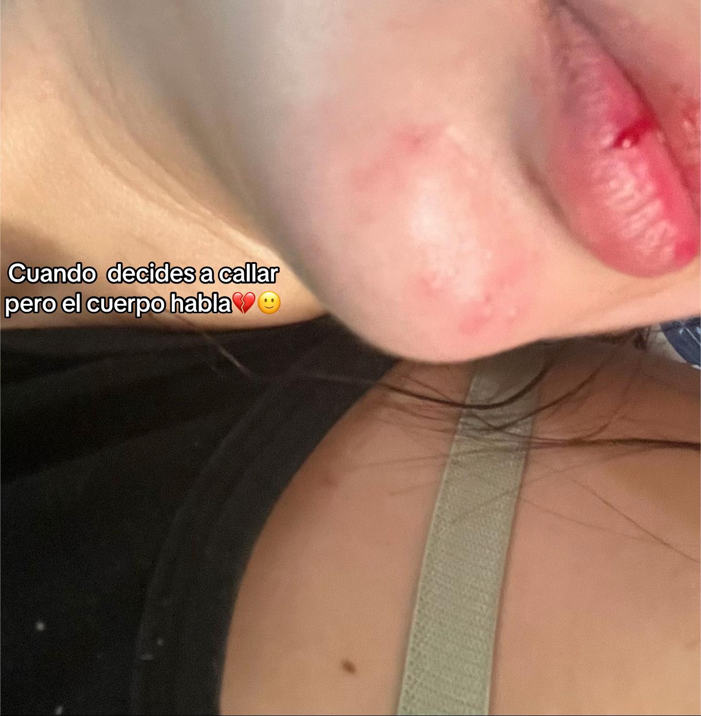 @Yamileth🇭🇳❤️🔥❤️🩹🦕🌽