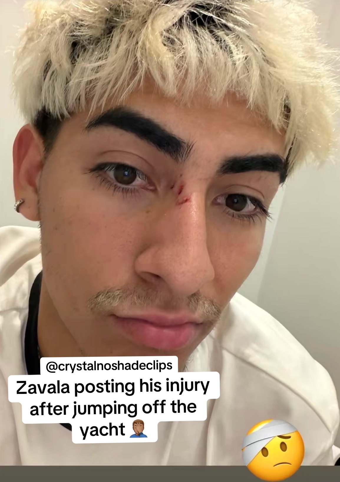 @crystalsnoshadeclips