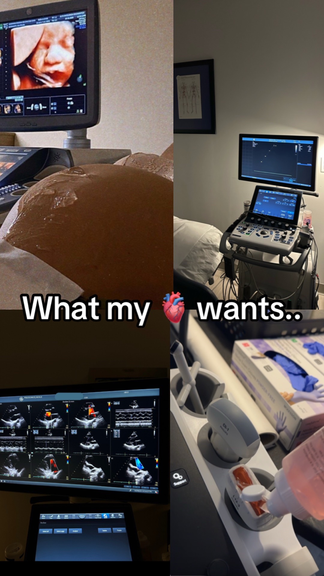 @_.mommi.p._