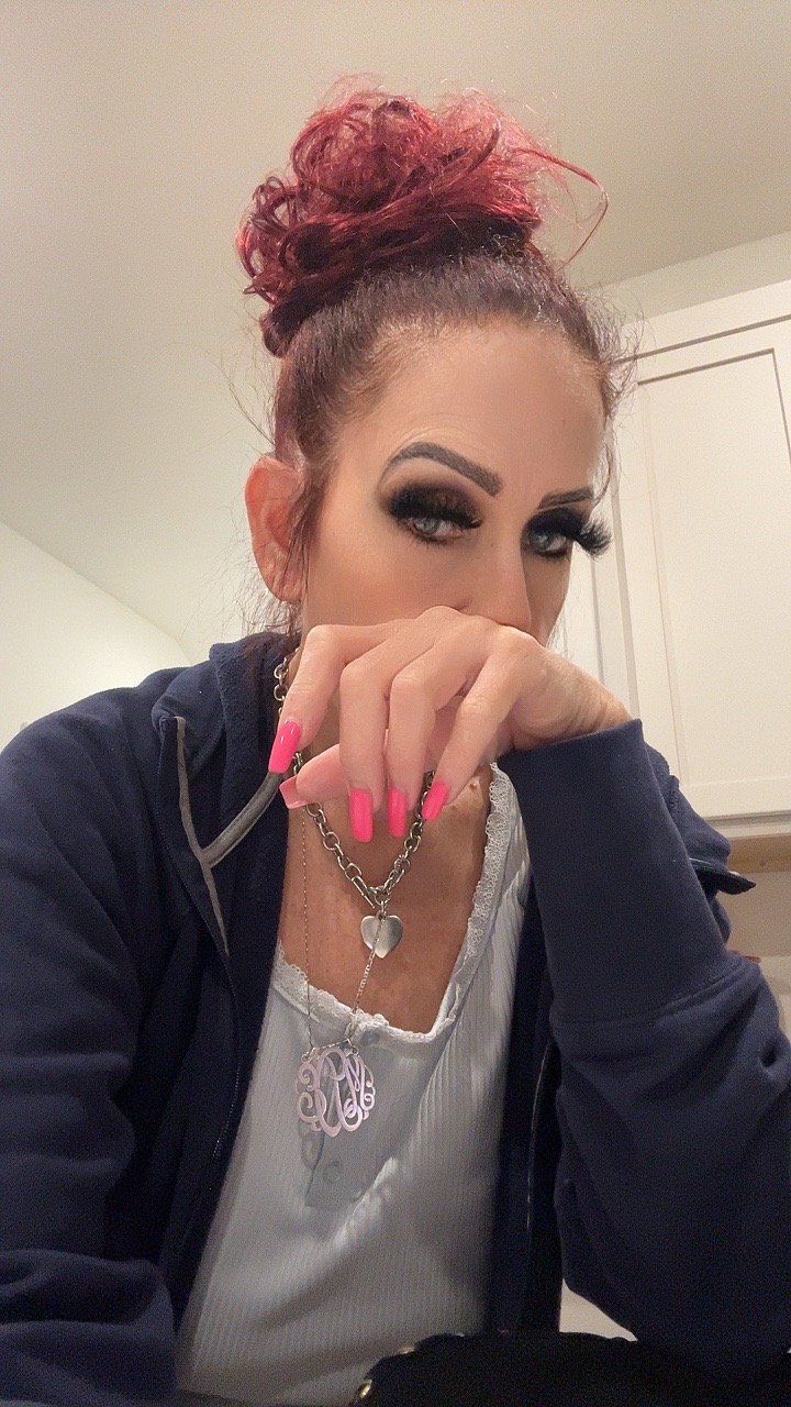 @Official Misty Dawn