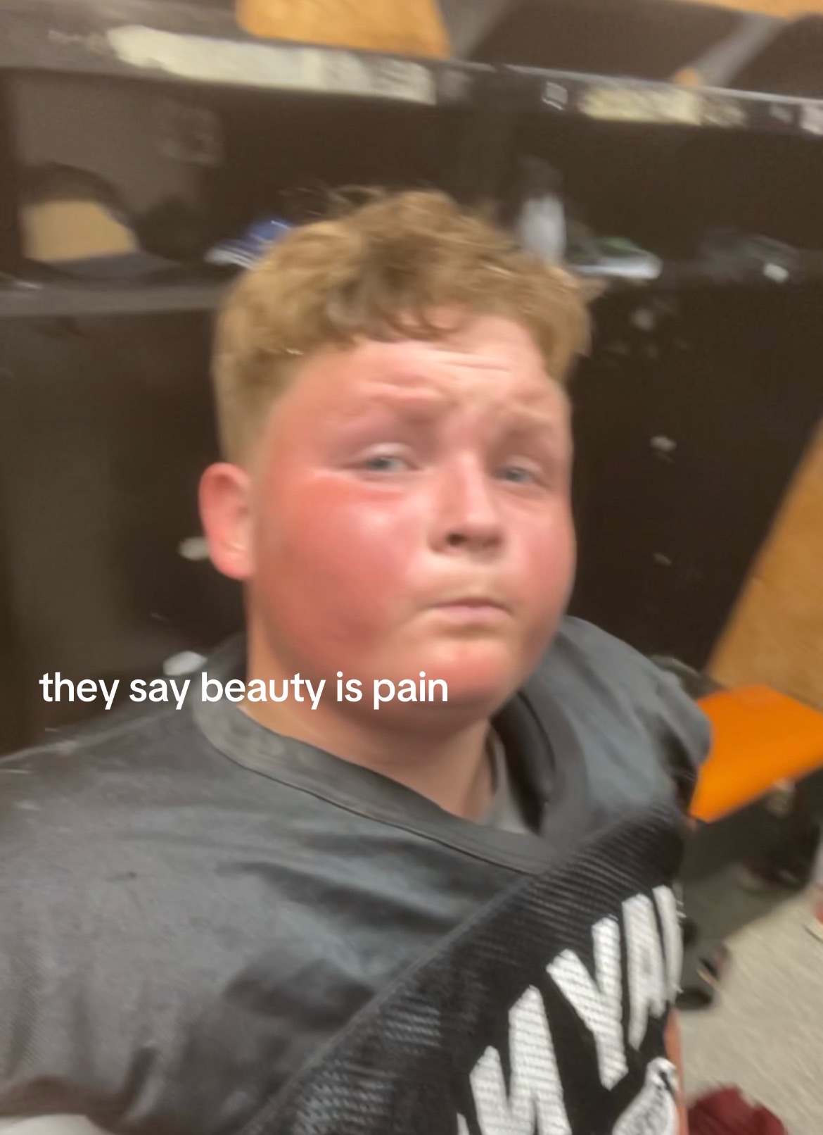 @X_gains