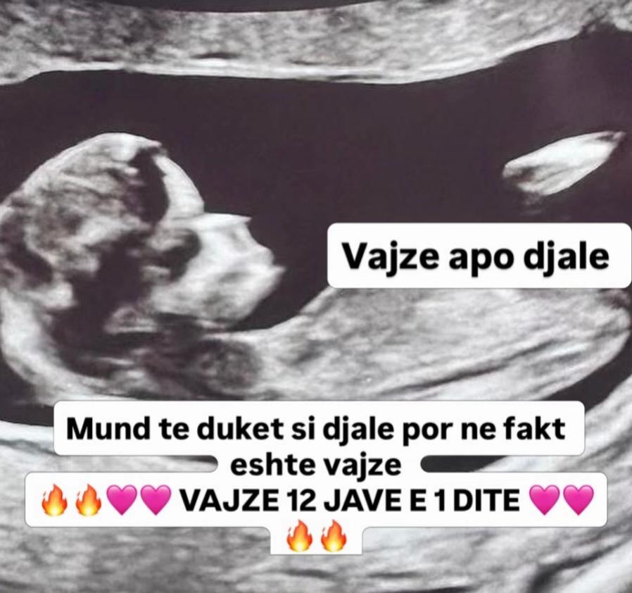 @Vajze apo Djale? 💙💖