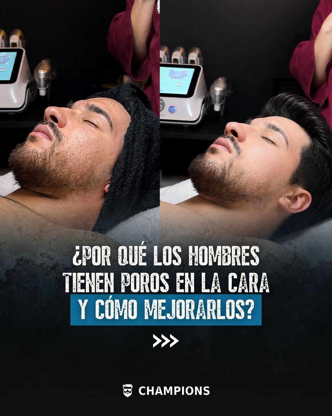 @Champions.men