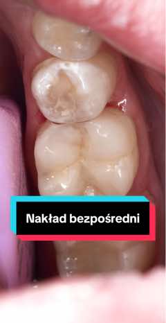 @Anna 🦷 dentystka