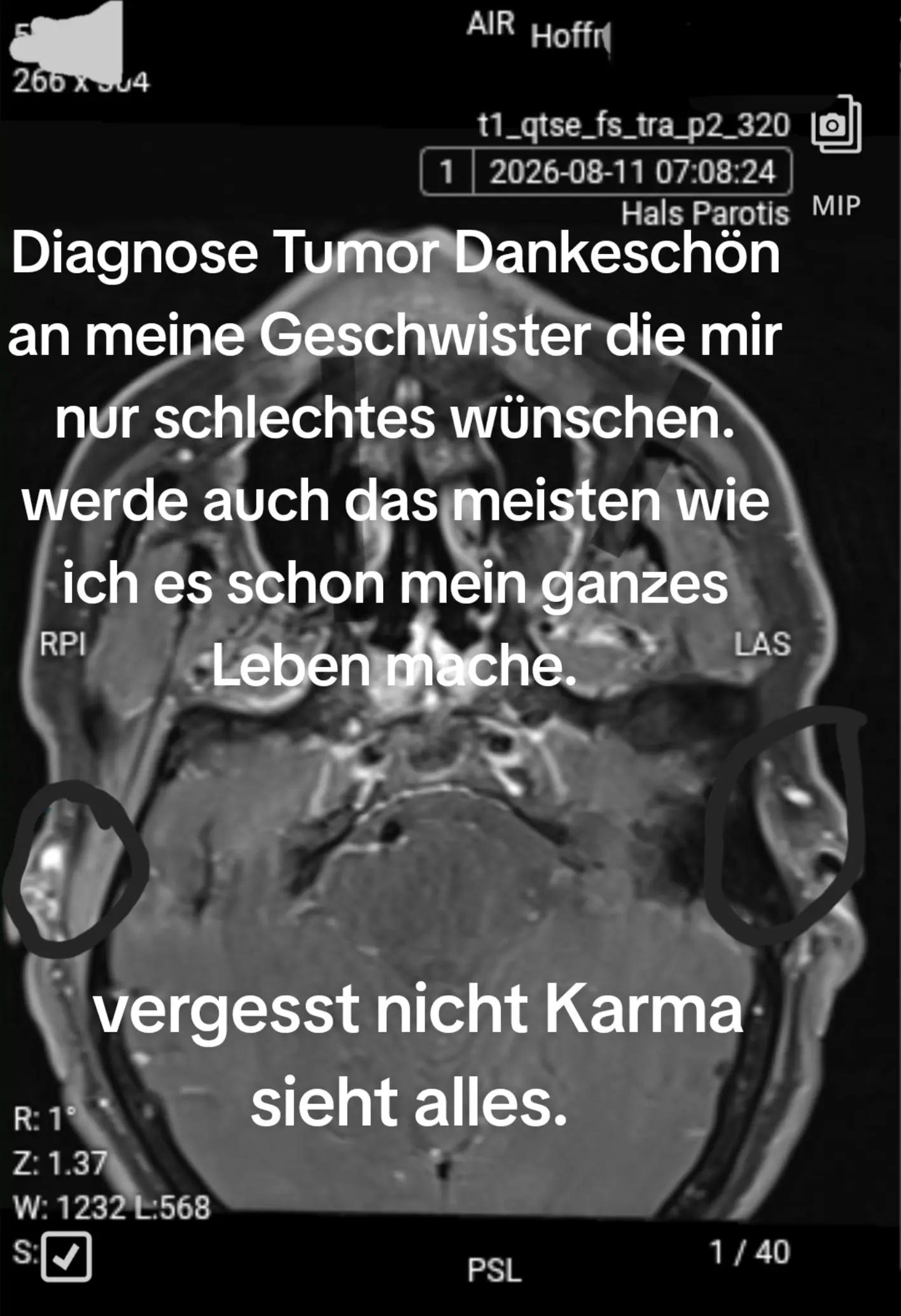 @Schwarzes Scharf