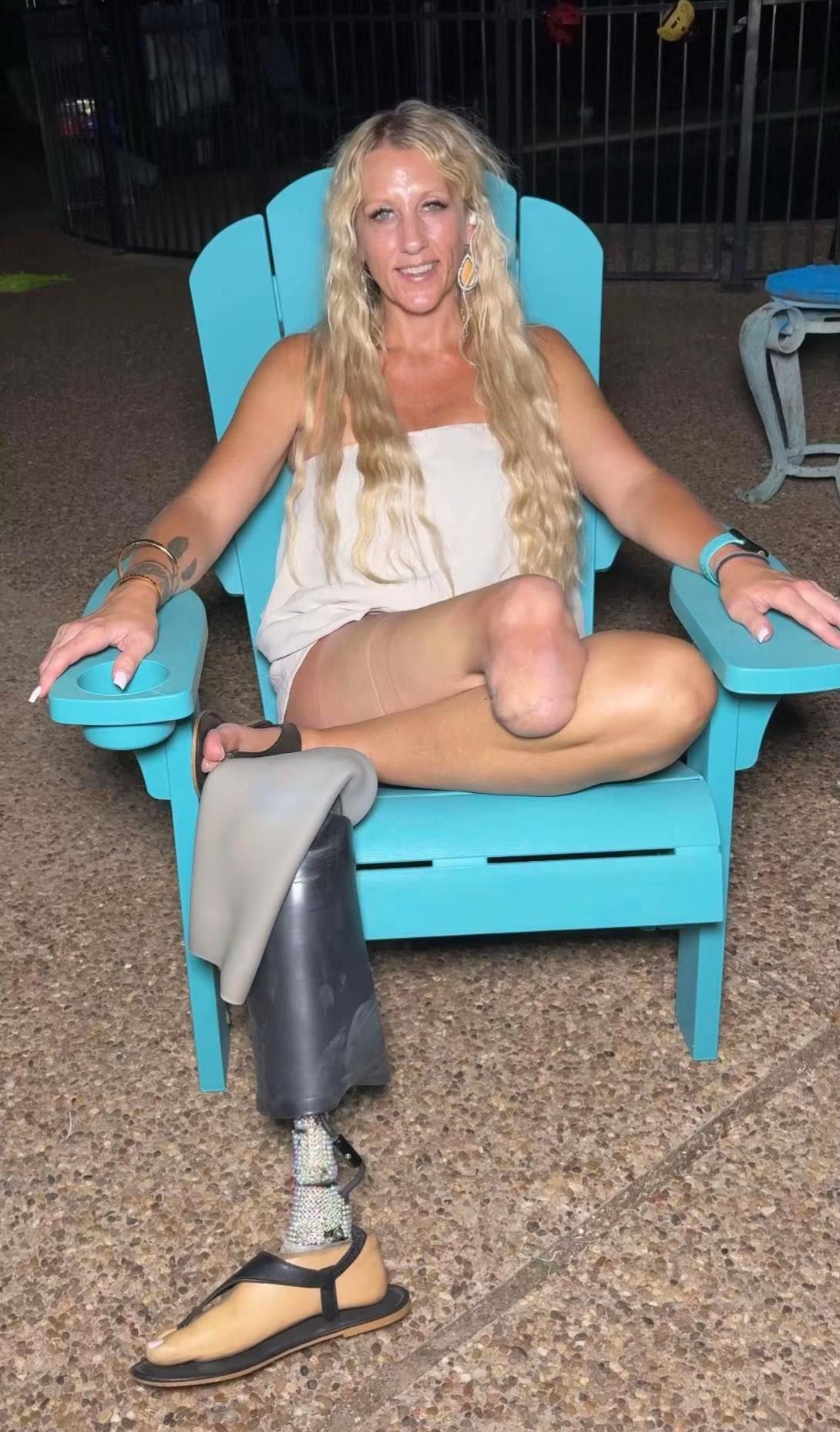 @AmputeeAngie2555
