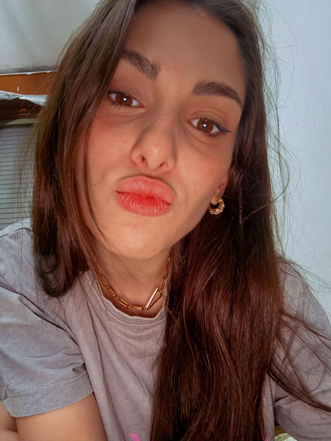 @chia🧚🏼&zwj;♀️💞😽🍒✨