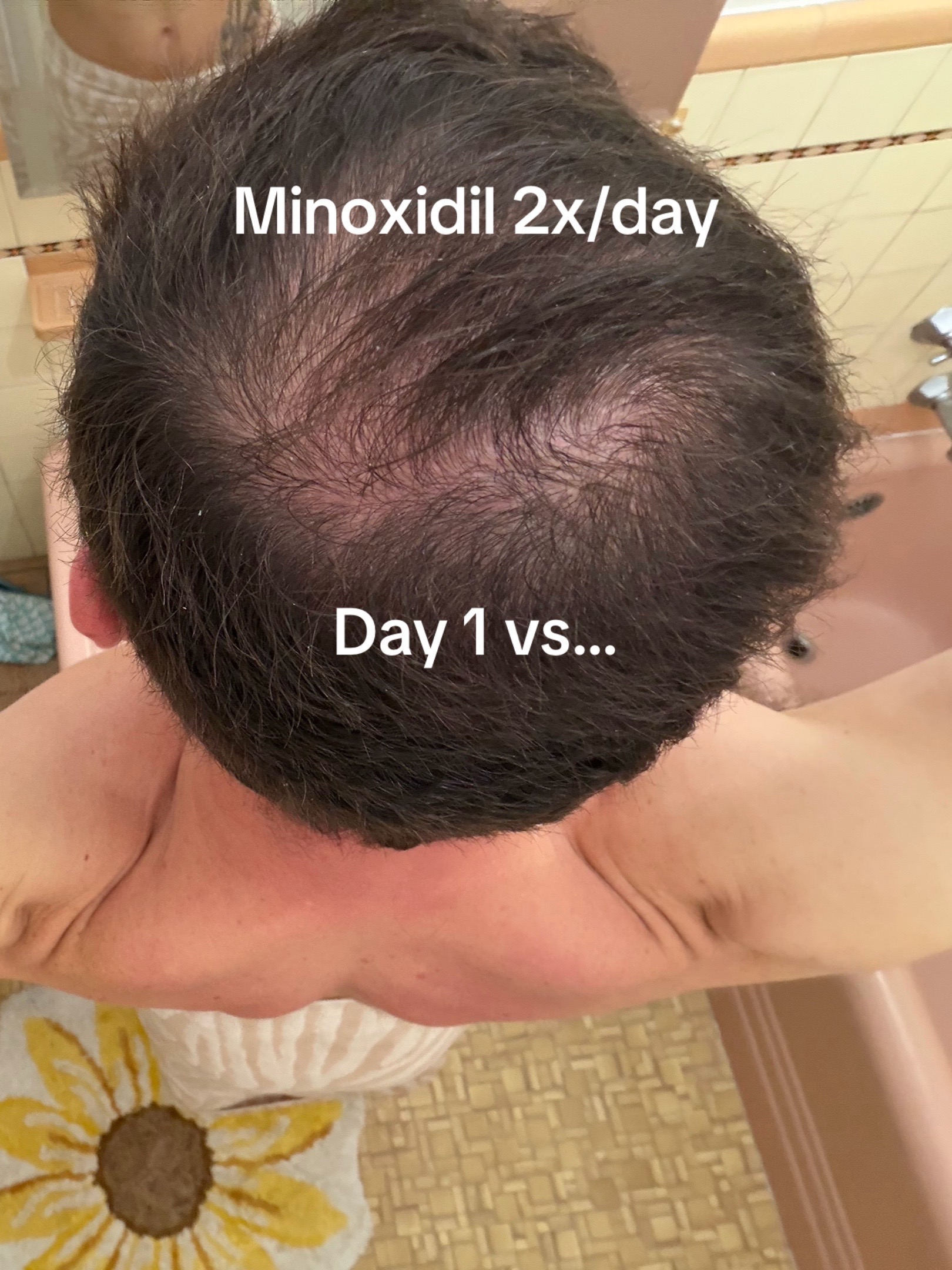 @scalp.hero