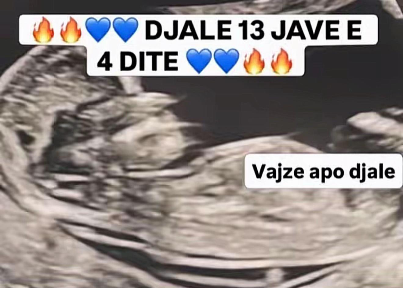@Vajze apo Djale? 💙💖