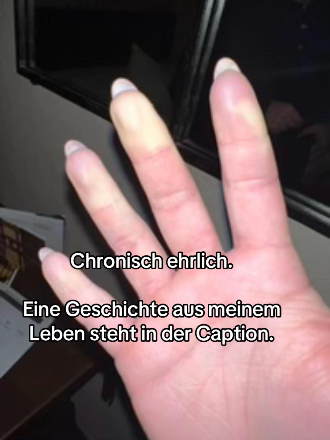 @Anika Schreiber