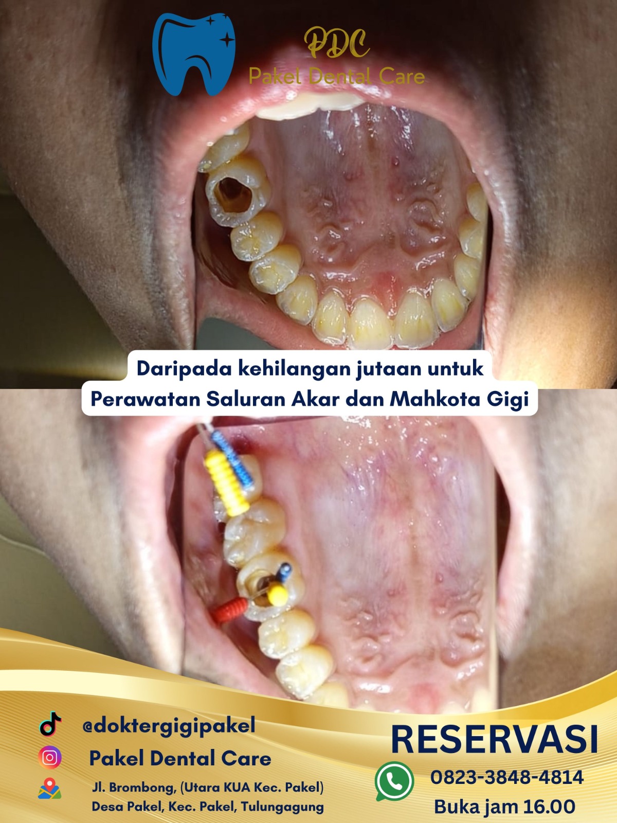 @Pakeldentalcare